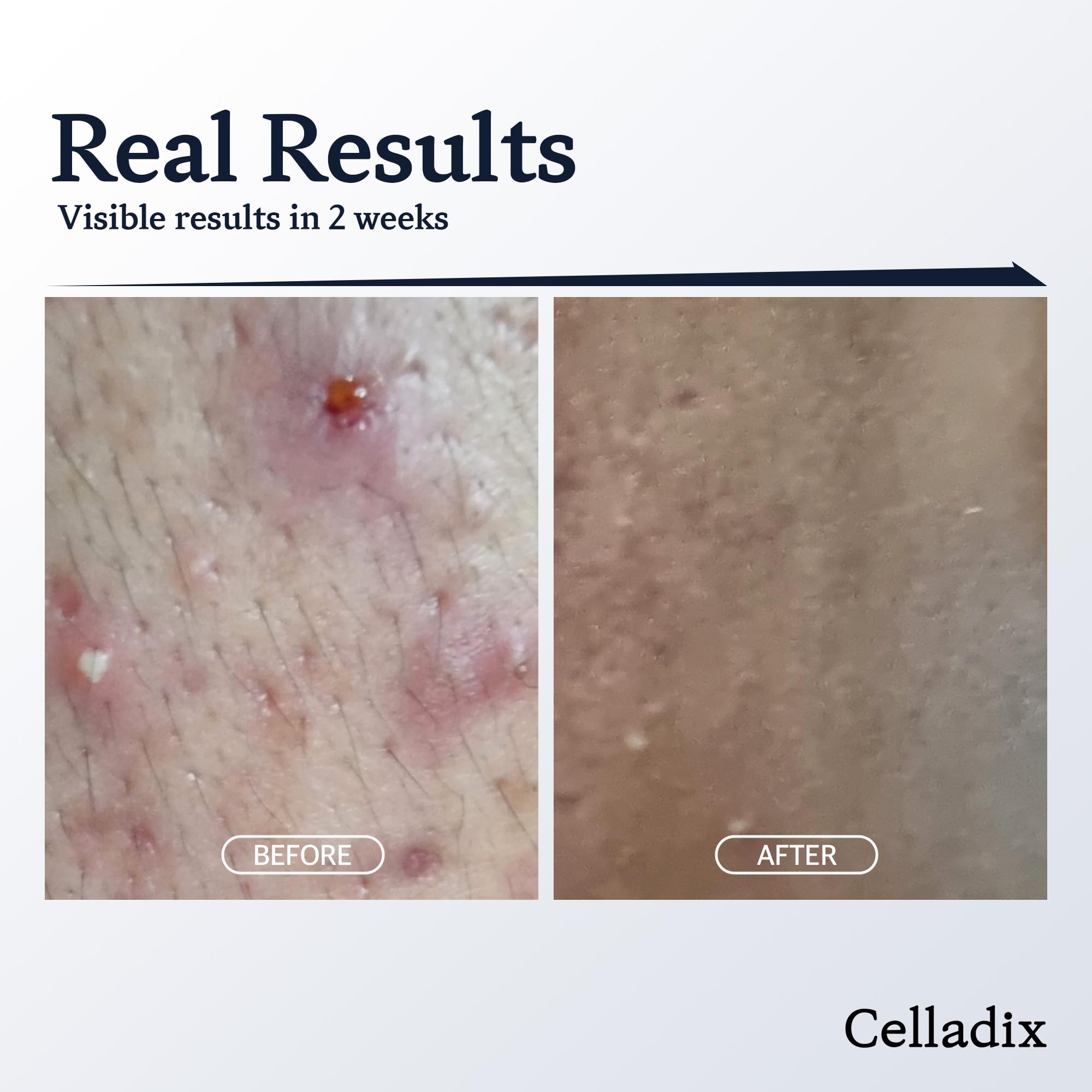 Celladix Skin Barrier Recovery 131 Cream | Skin Microbiome Protects | Strengthens Skin Barrier | Oil-Free Face Cream | Optimal 5