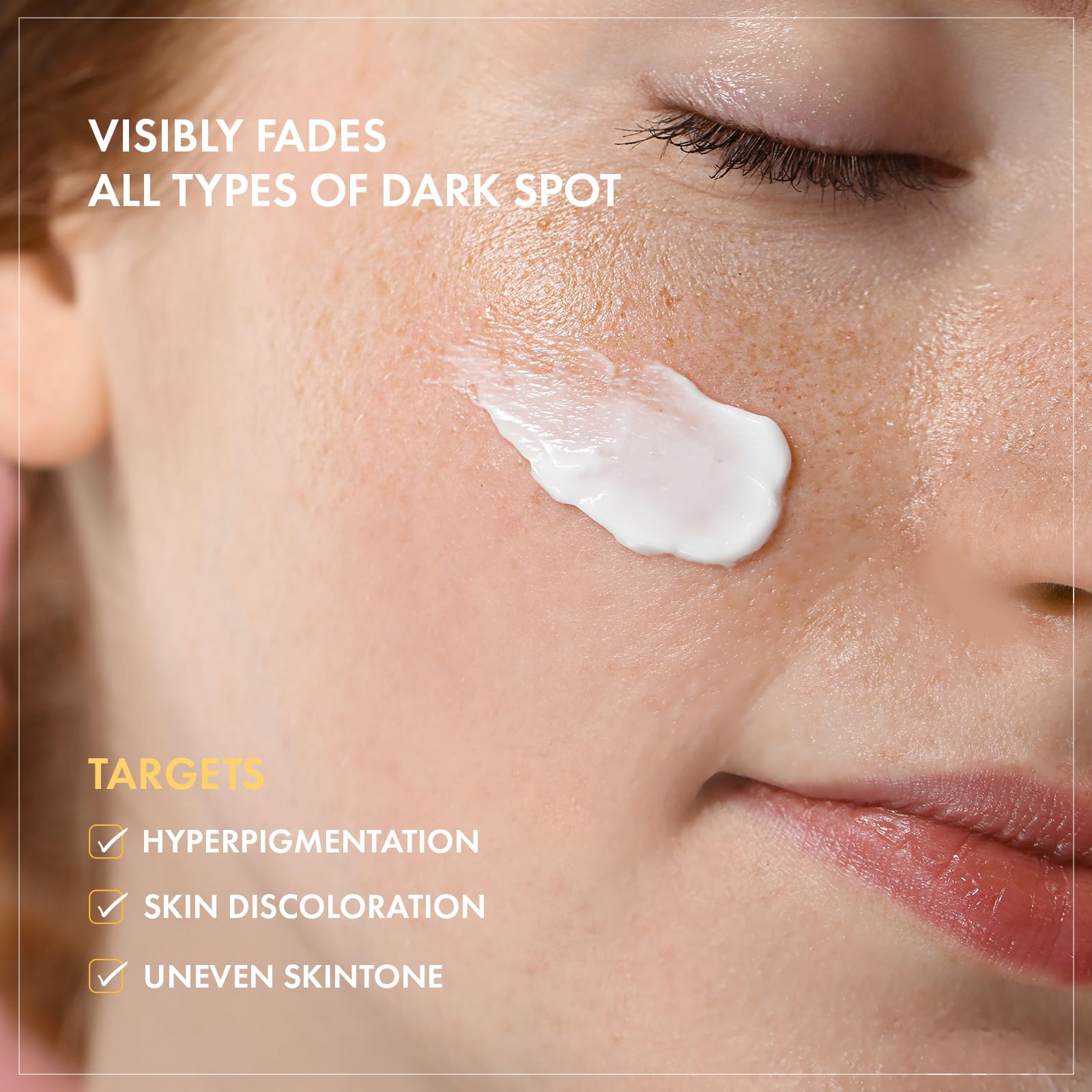 TOSOWOONG 8 Days Spot Cream, Dark Spot Remover for Face, Age Spot, Sun Spot, Freckles, Melasma, Brown Spot Serum, Advanced Formu