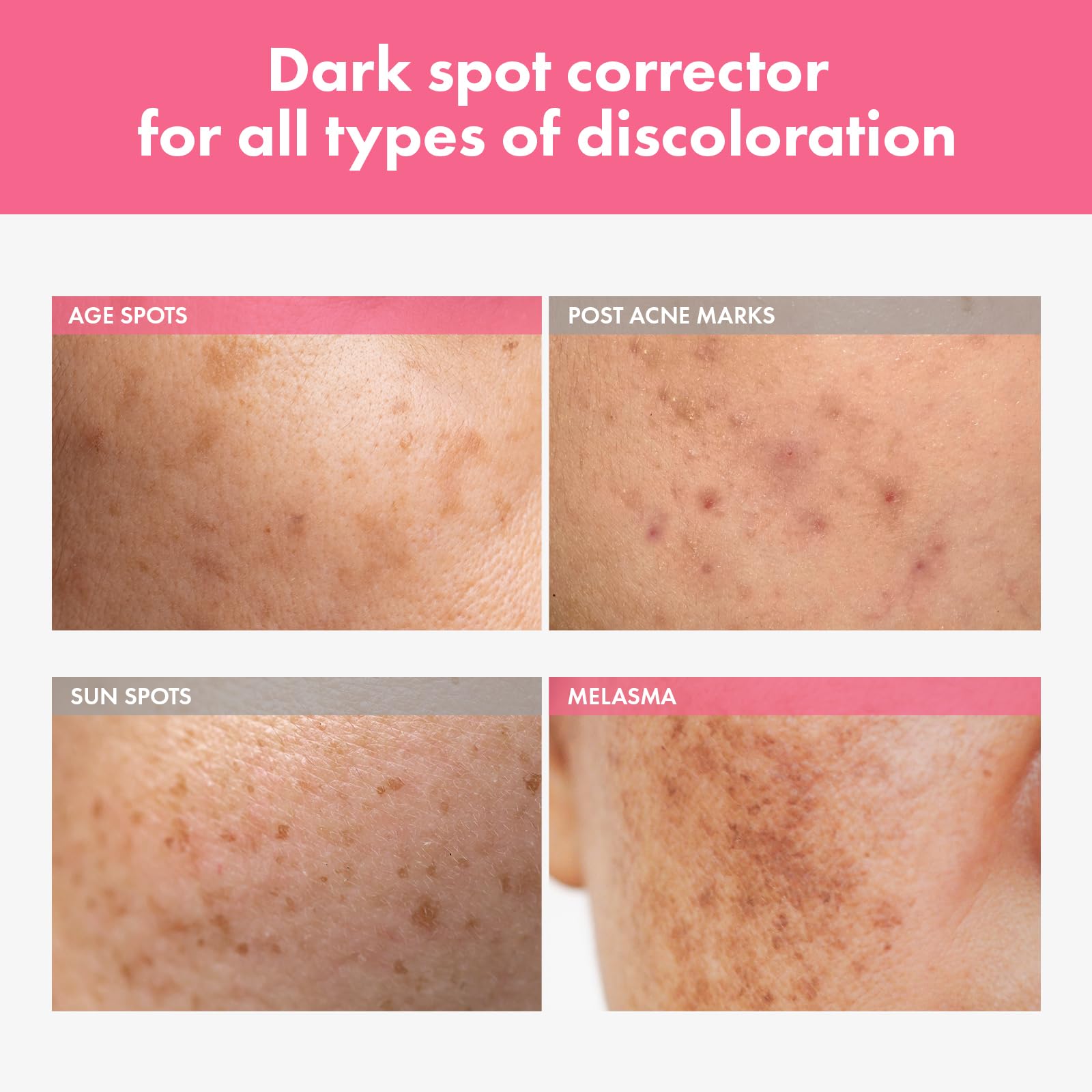 TOSOWOONG Arbutin 7% Intensive Spot Cream with 70,000ppm Arbutin, 3% Tranexamic Acid, 1% Niacinamide, Glutathione, Dark Spots, f