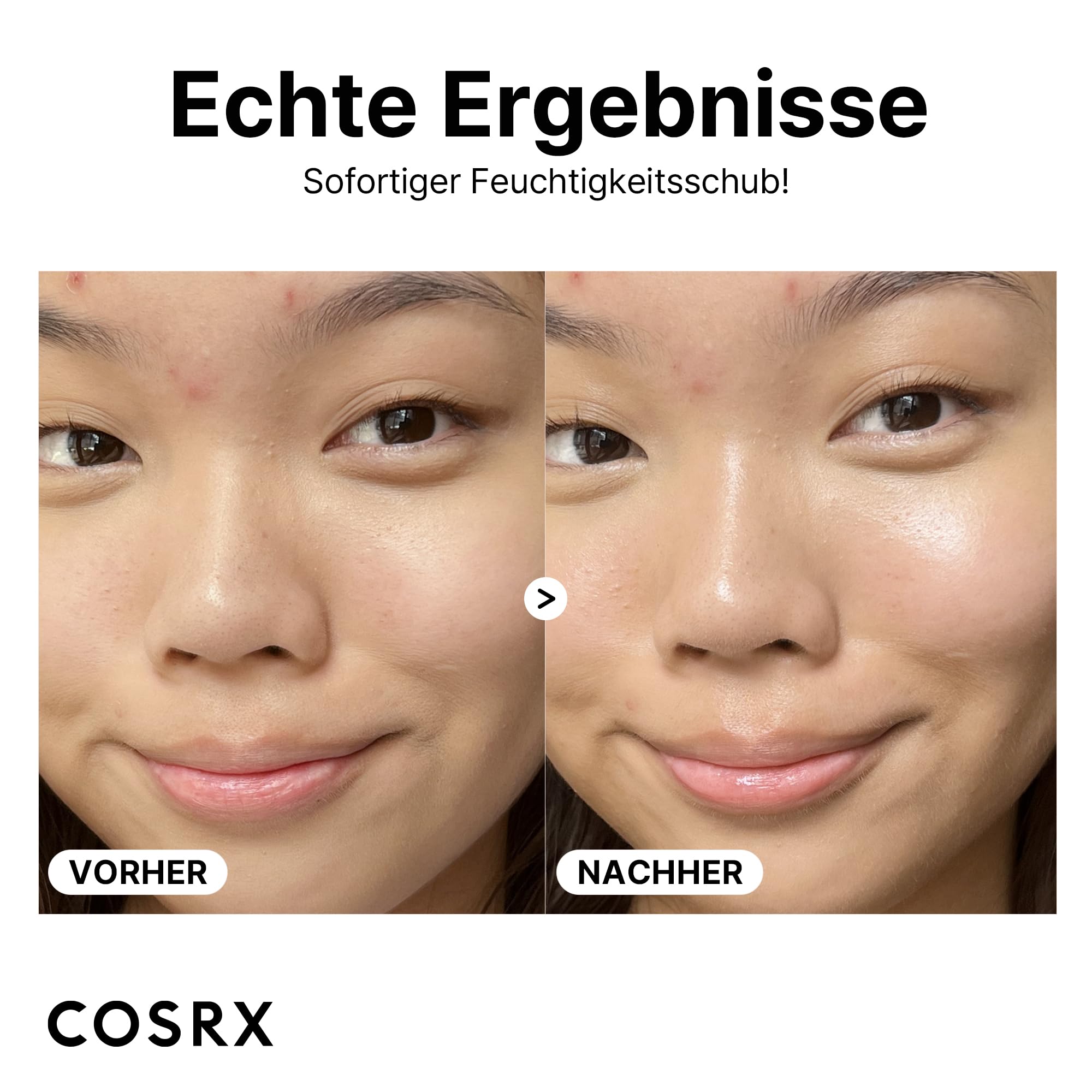Cosrx Pure Sodium Hyaluronic Acid 3% Serum, Hydration & Moisture Boosting Facial Serum For Fine Lines & Wrinkles, Plump & Repair