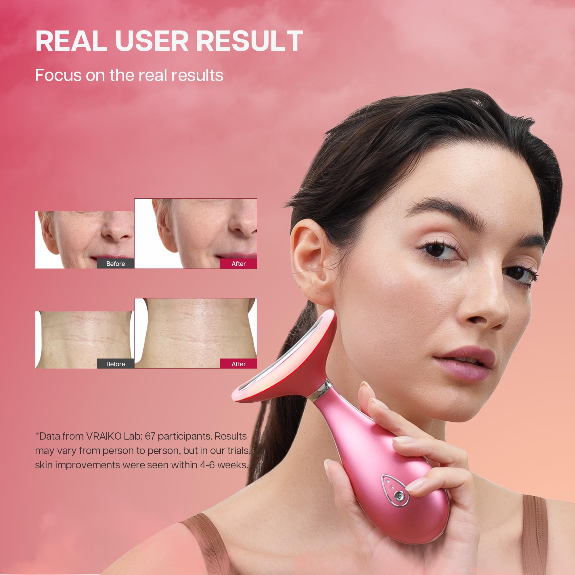 Vraiko Lily Neck Face Massager, Face Sculpting Tool, 3-In-1 Facial Device With Thermal, Triple Action Care, For Enhanced Absorpt