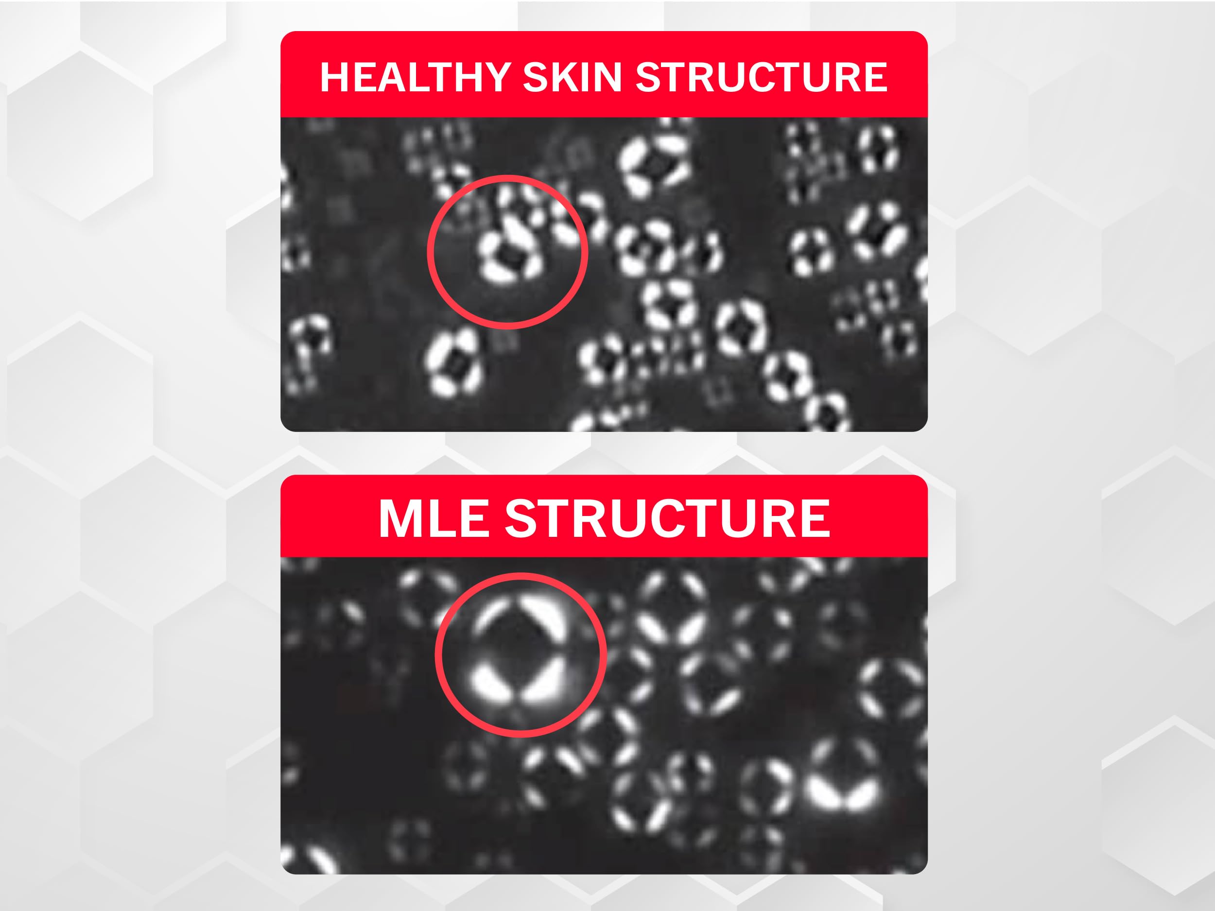 ATOPALM | Intensive Moisturizing Cream | Face & Body Moisturizer | For Dry & Sensitive Skin | Paraben-Free Lotion | Replenishes