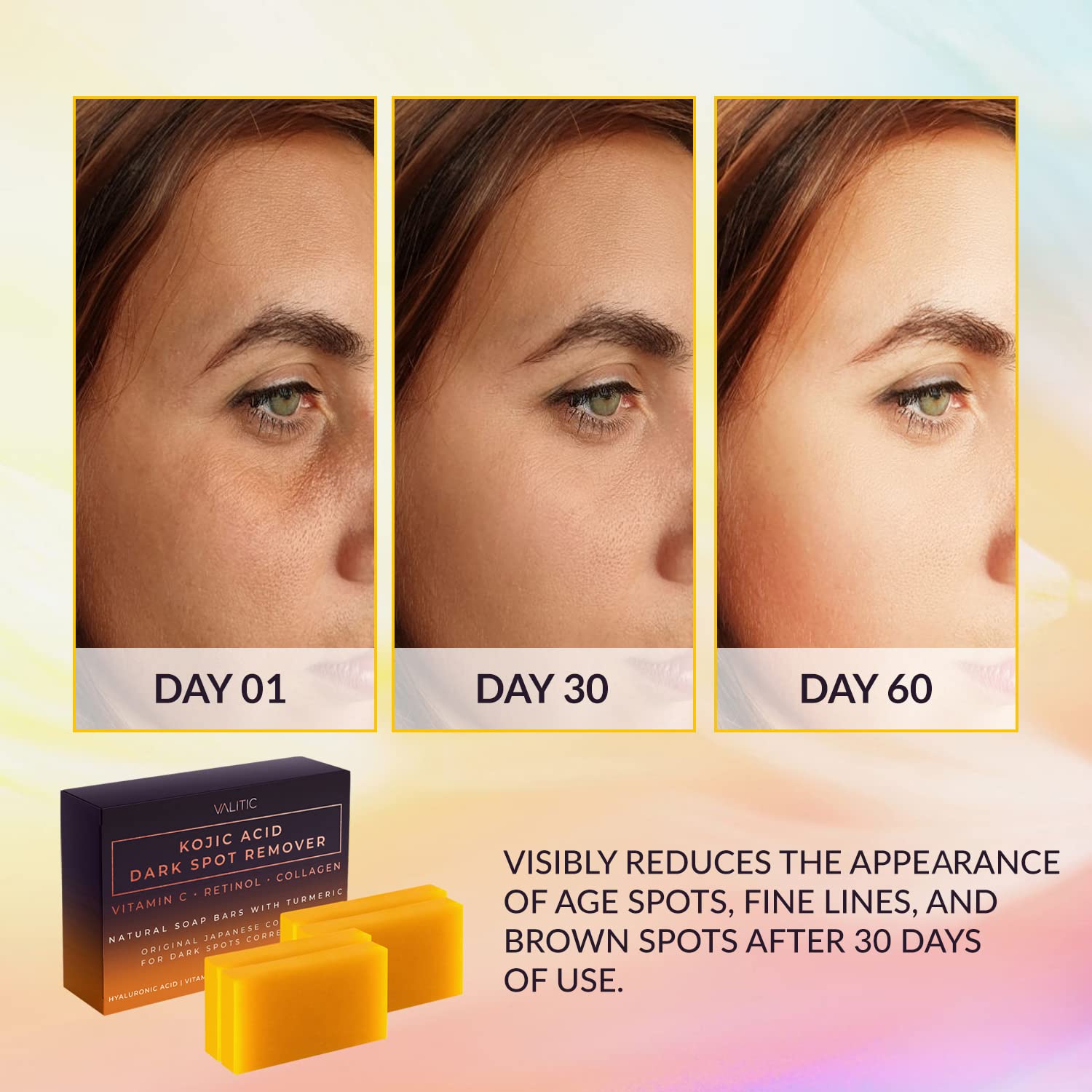Valitic Kojic Acid Dark Spot Remover Soap Bar With Vitamin C, Retinol, Collagen, Turmeric - Original Japanese Complex - Hyaluron