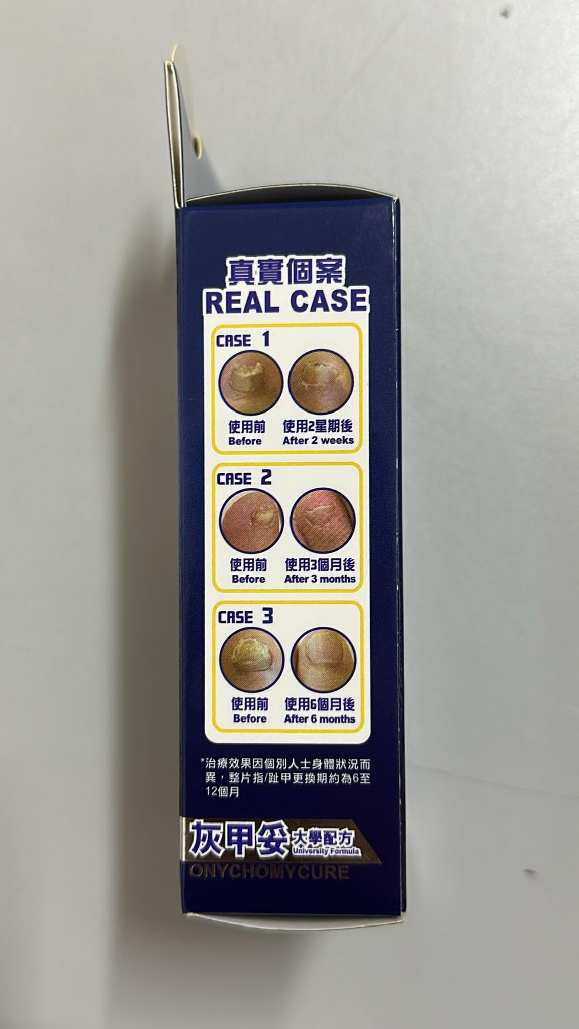 NOTO Onychomycure Strength Toenail Nail Good - Repair Healthy Nail/foot, Foot Care, Appearance Renewal Nail Repair Solution, Fix
