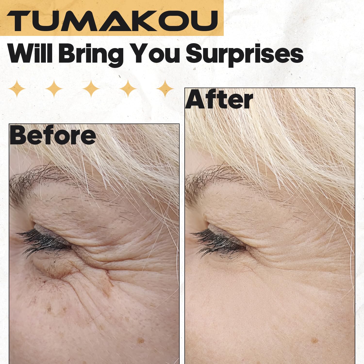 High Frequency Mushroom Glass Tube Replacement for TUMAKOU High Frequency Facial Wand - Orange Accessory (Mushroom Tube)