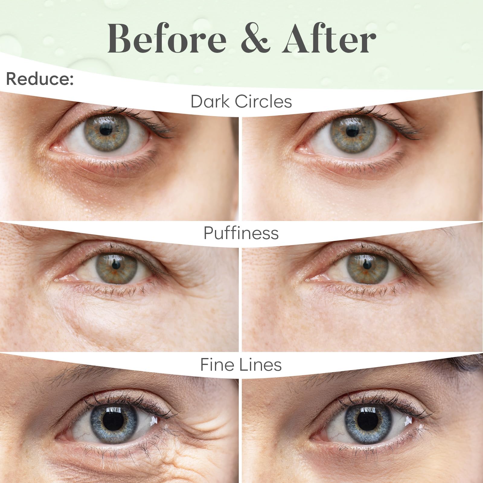 BLOOMORA Green Tea Eye Patches (30 Pairs) Under Eye Patches for Dark Circles, Under Eye Patches for Puffy Eyes and Dark Circles,