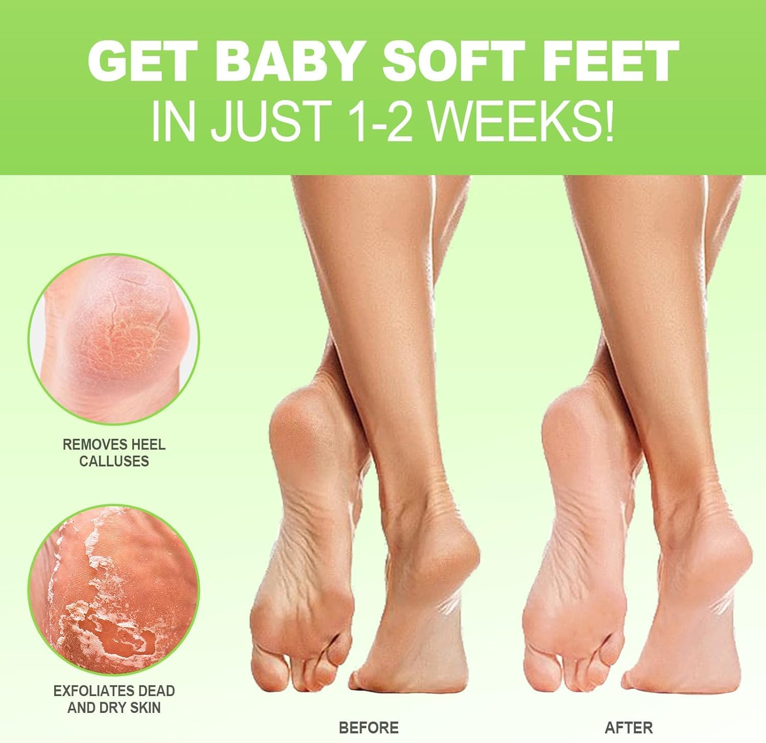 Foot Peel Mask - 3 Pairs - Exfoliating Peeling Callus Remover, Repairs Cracked Heels & Dry Skin, for Smoother and Softer Feet (A
