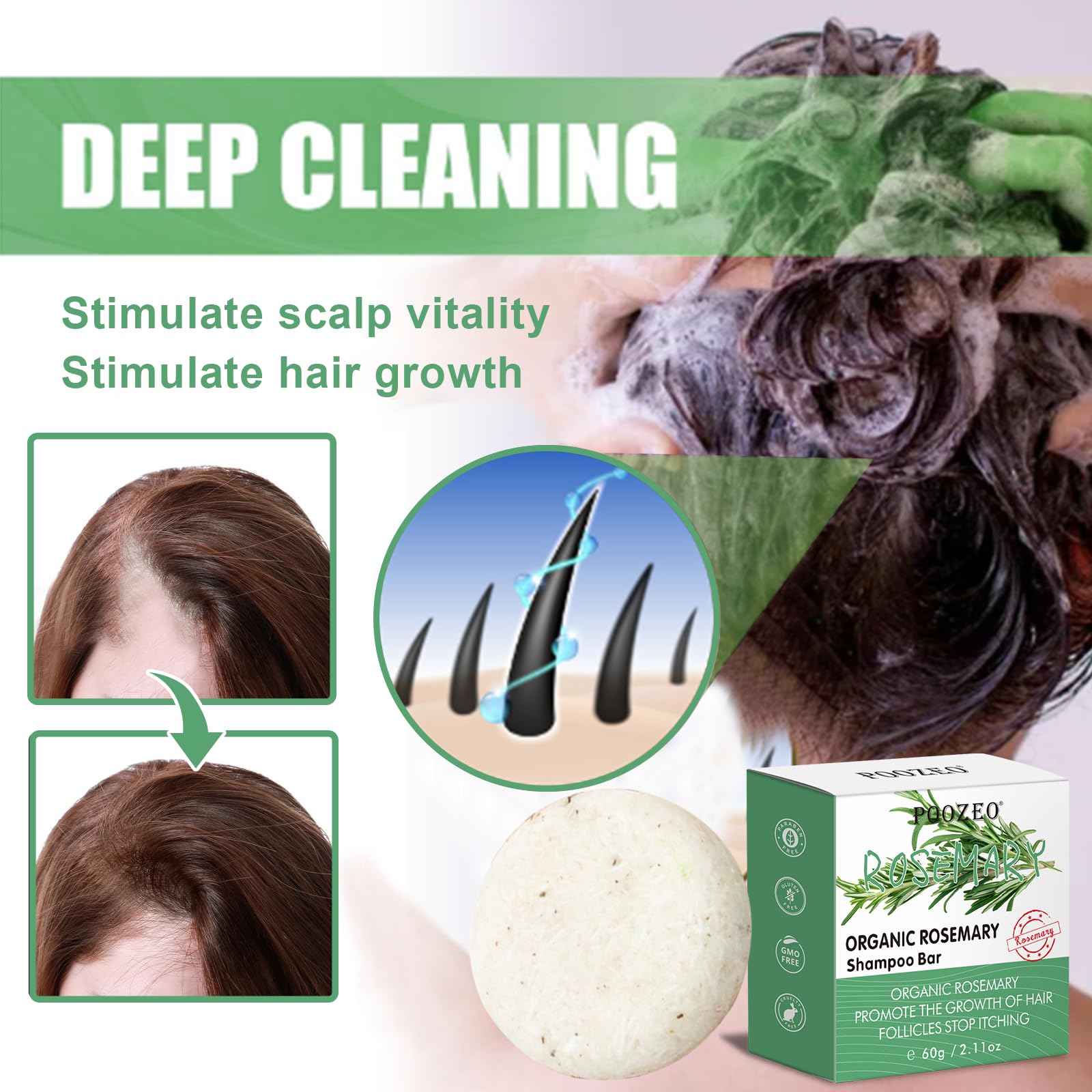 Dbeautym 2 Pack Rosemary Hair Shampoo Bar,Deep Cleansing For Scalp Hair Loss Shampoo Soap,Organic Hair Oil Control,Solid Shampoo