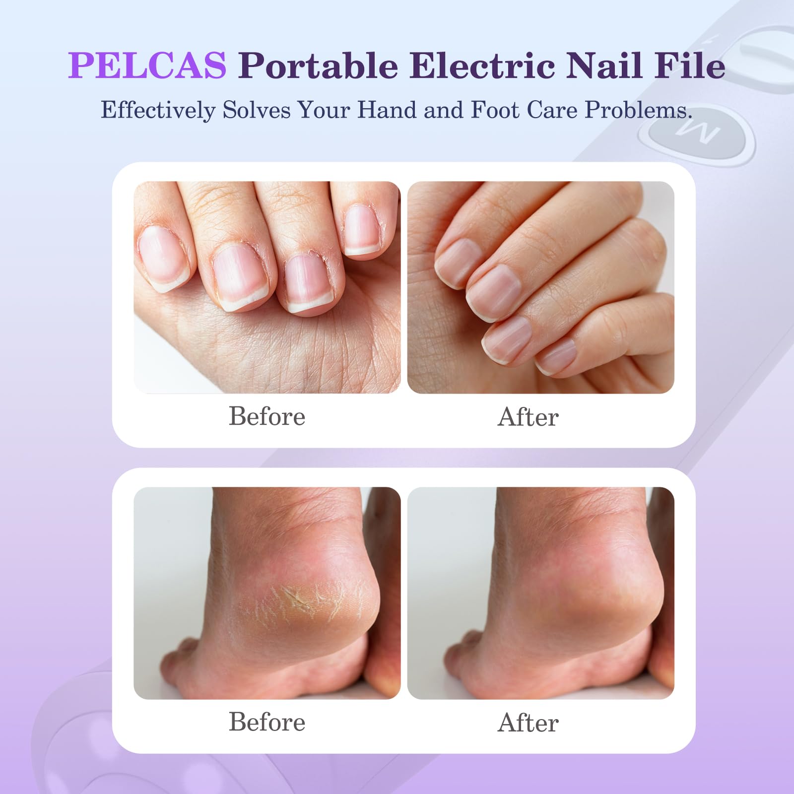 PELCAS Electric Nail Drills, 10 Speeds Cordless Nail File with LED Light, Portable Manicure & Pedicure Kit, Nail Grinder with LC