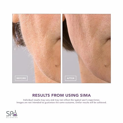 SPA SCIENCES SIMA Sonic Dermaplaning Tool - Painless Facial Exfoliation, 3 Speeds, Rechargeable, Pink, Stainless Steel, Model 860021001123