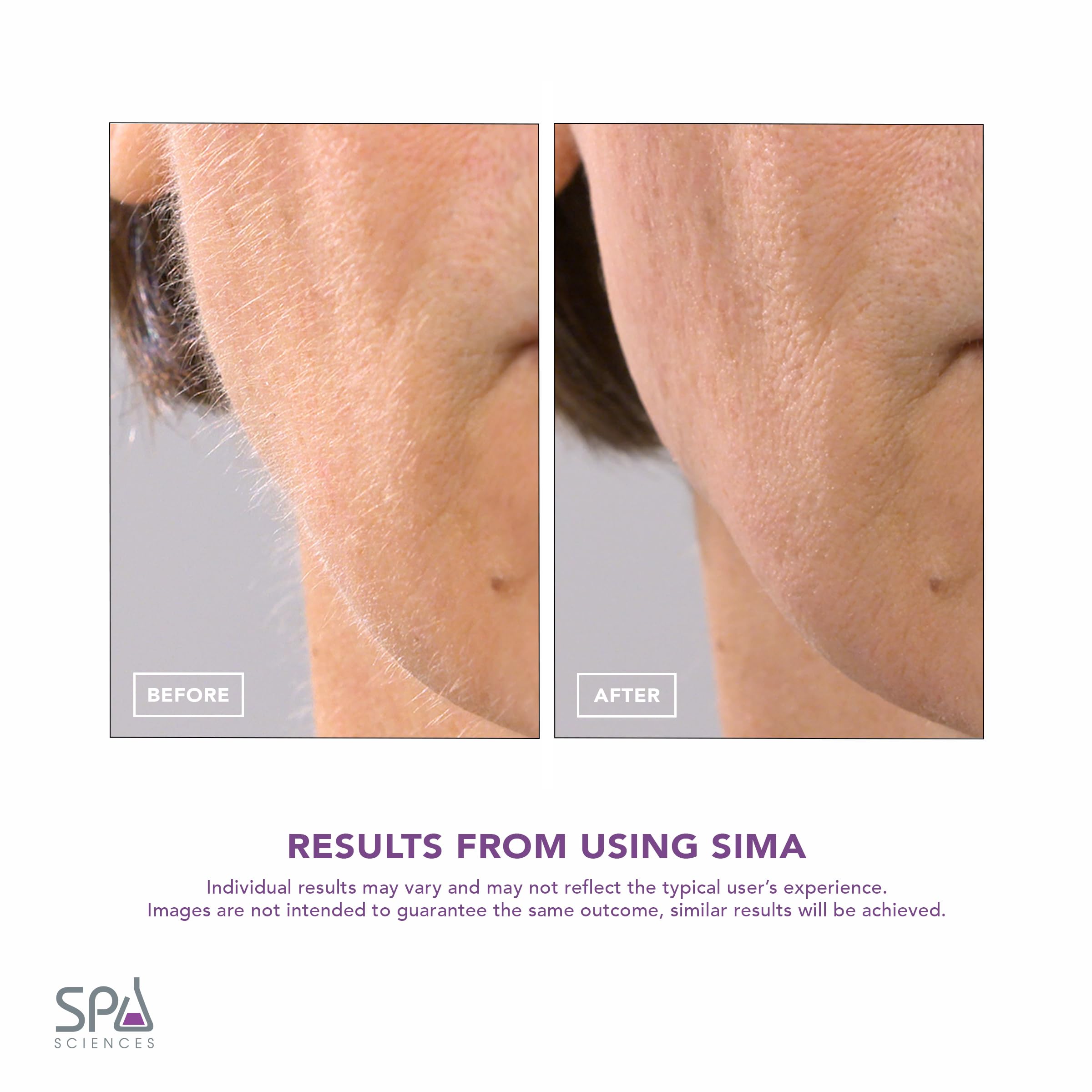 SPA SCIENCES - SIMA Patented Dermaplane Razor for Women Face - Painless 2-in-1 Facial Exfoliation & Peach Fuzz Hair Removal - An