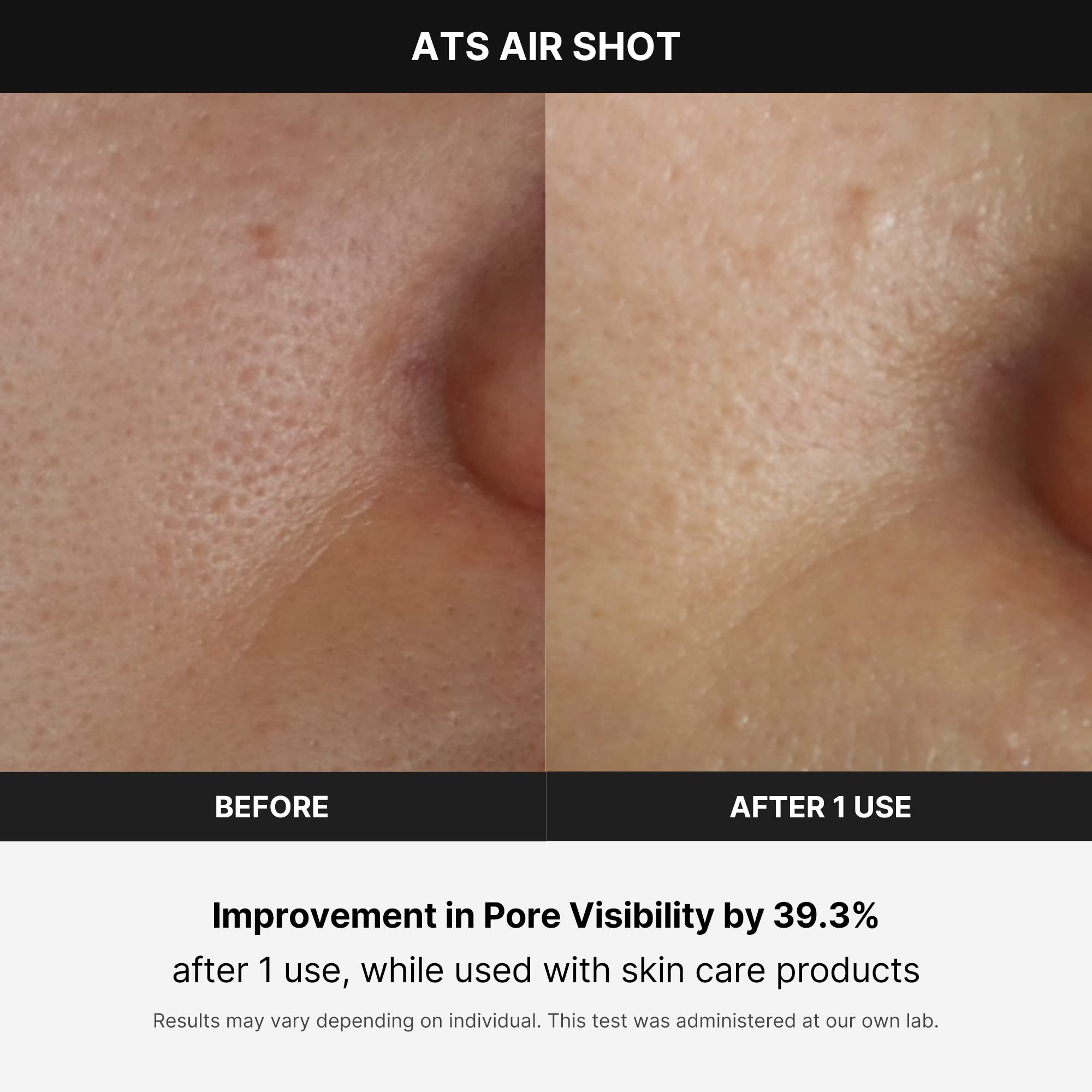 Medicube Age-R Ats Air Shot - Microneedling Skin Care Device For Pore Tightening, Enhanced Absorption, And Smoother Skin Texture