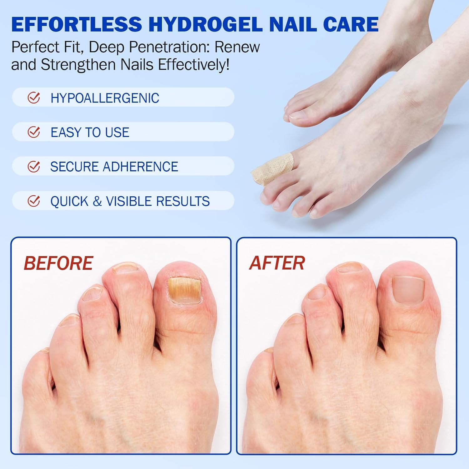 Fungal Nail Patches, Nail patches for toenails, Overnight Toe Nails Treatments for Damaged Foot Nails Repair and Care, Safe for