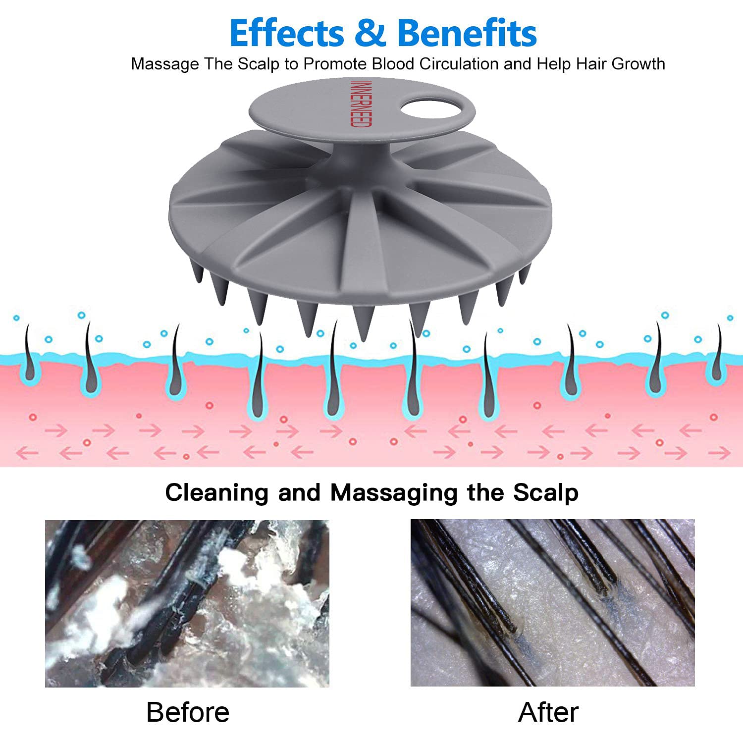 Innerneed One-Piece Scalp Massager Shampoo Brush, Wet & Dry Scalp Care Head Scrubber Hair Washing, Soft Silicone Bristles, For H