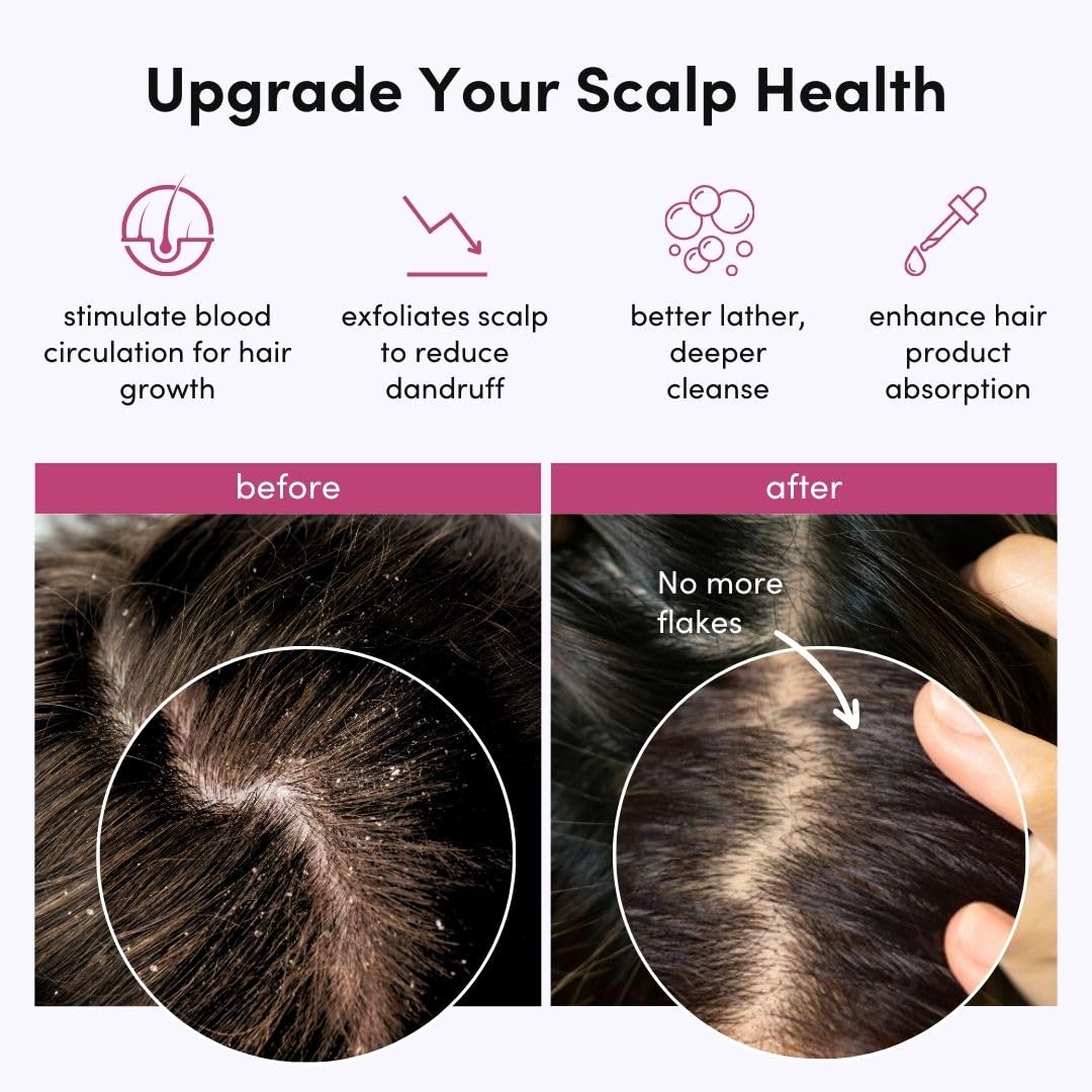 Fancii Hair Scalp Massager, Shampoo Brush For Wet & Dry Hair, Scalp Scrubber Exfoliator For Dandruff Removal & Hair Growth. Show