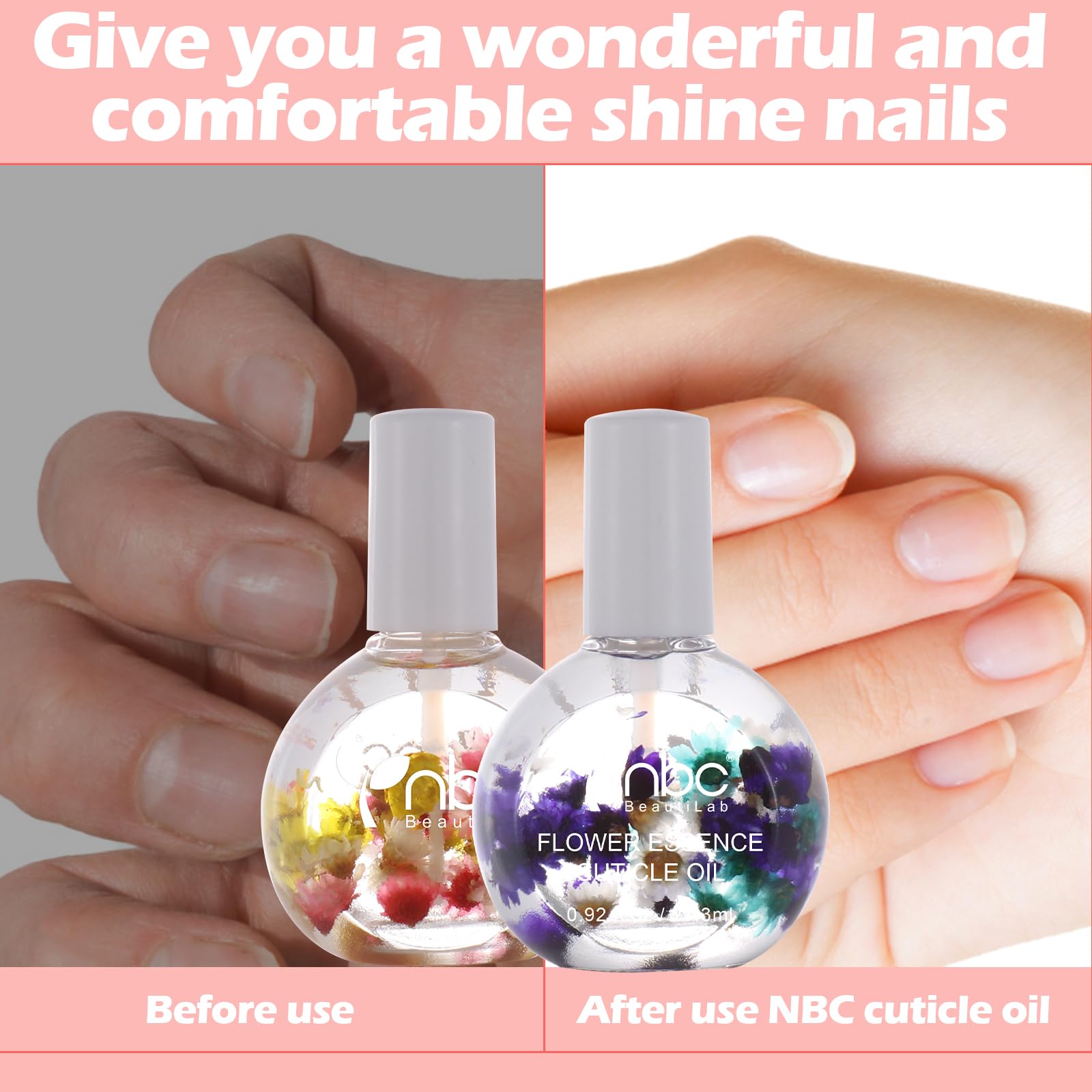Nbc Beautilab Flower Essence Cuticle Oil. Use Natural Ingredients And Vitamin E To Moisturize And Activate The Cracked And Hard