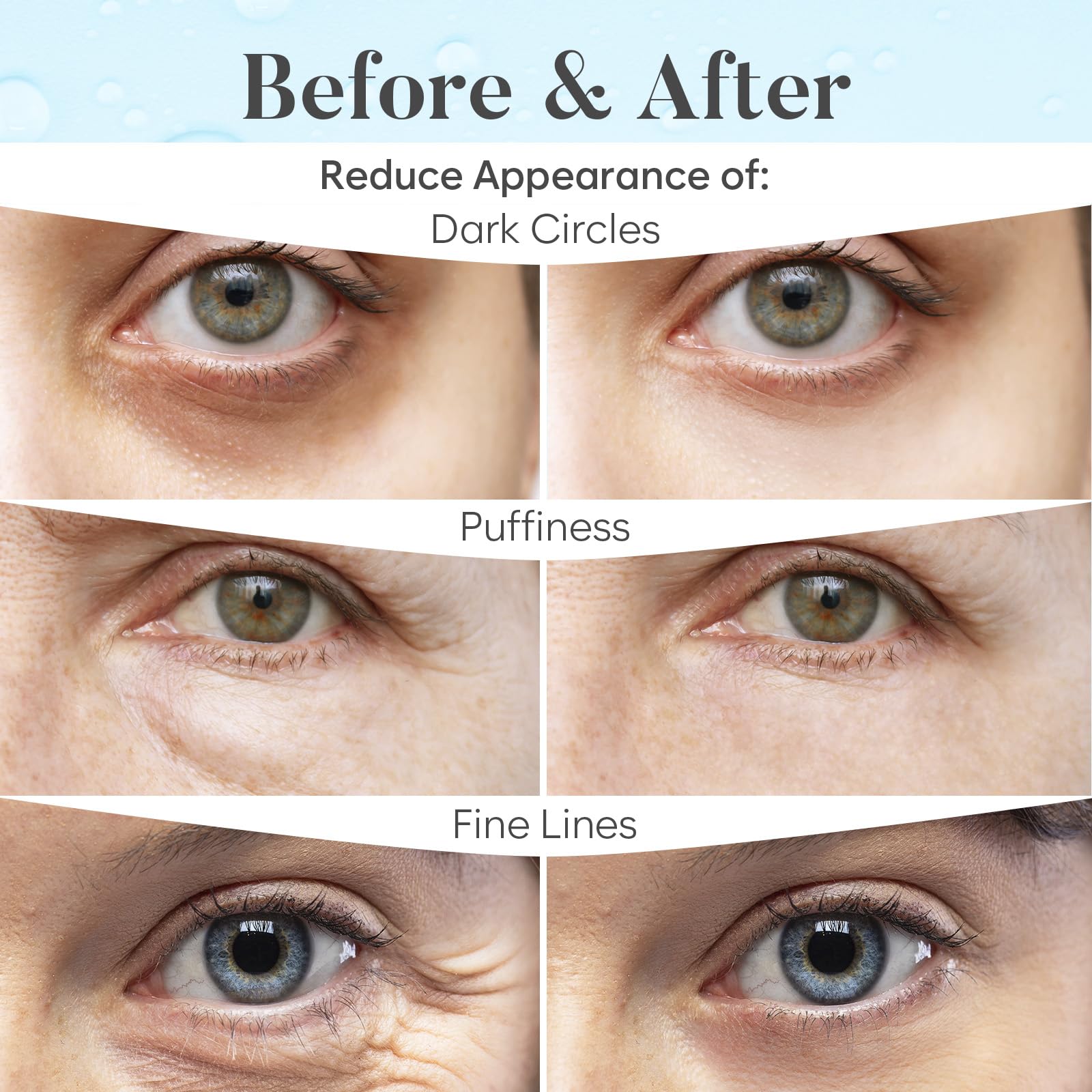 BLOOMORA Marine Collagen Under Eye Patches (30 PAIRS), For Puffy Eyes and Dark Circles, Under Eye Mask with Hyaluronic Acid & Co