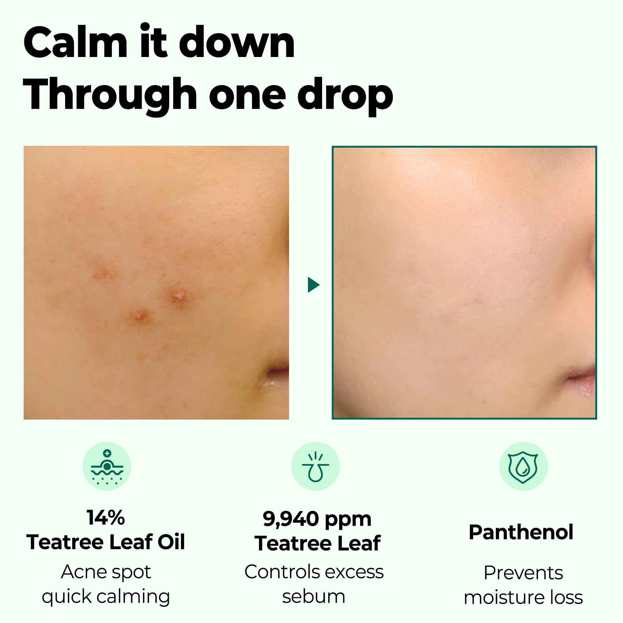 Some By Mi 30 Days Miracle Tea Tree Clear Spot Oil - 0.33Oz, 10Ml - Made From Tea Tree Leaf Water For Sensitive Skin - Calming,
