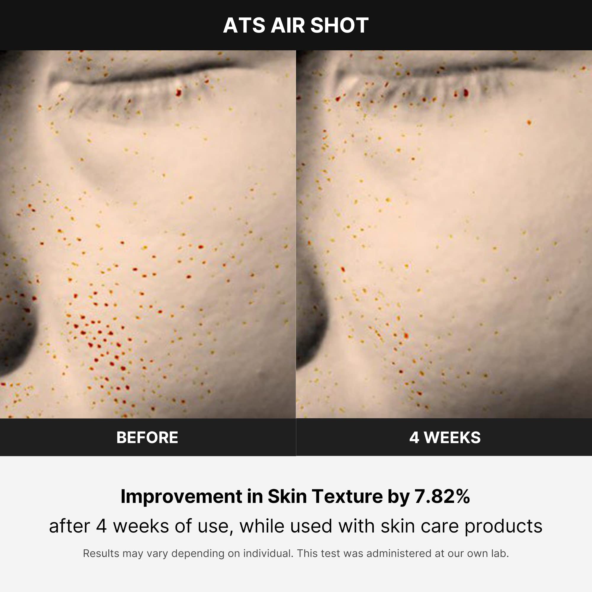 Medicube Age-R Ats Air Shot - Microneedling Skin Care Device For Pore Tightening, Enhanced Absorption, And Smoother Skin Texture