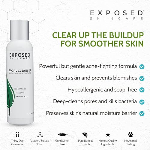 Exposed Skin Care Acne Facial Cleanser - Gentle Face Wash With Salicylic Acid For Acne Prone Skin - Pore Clarifying Acne Treatme