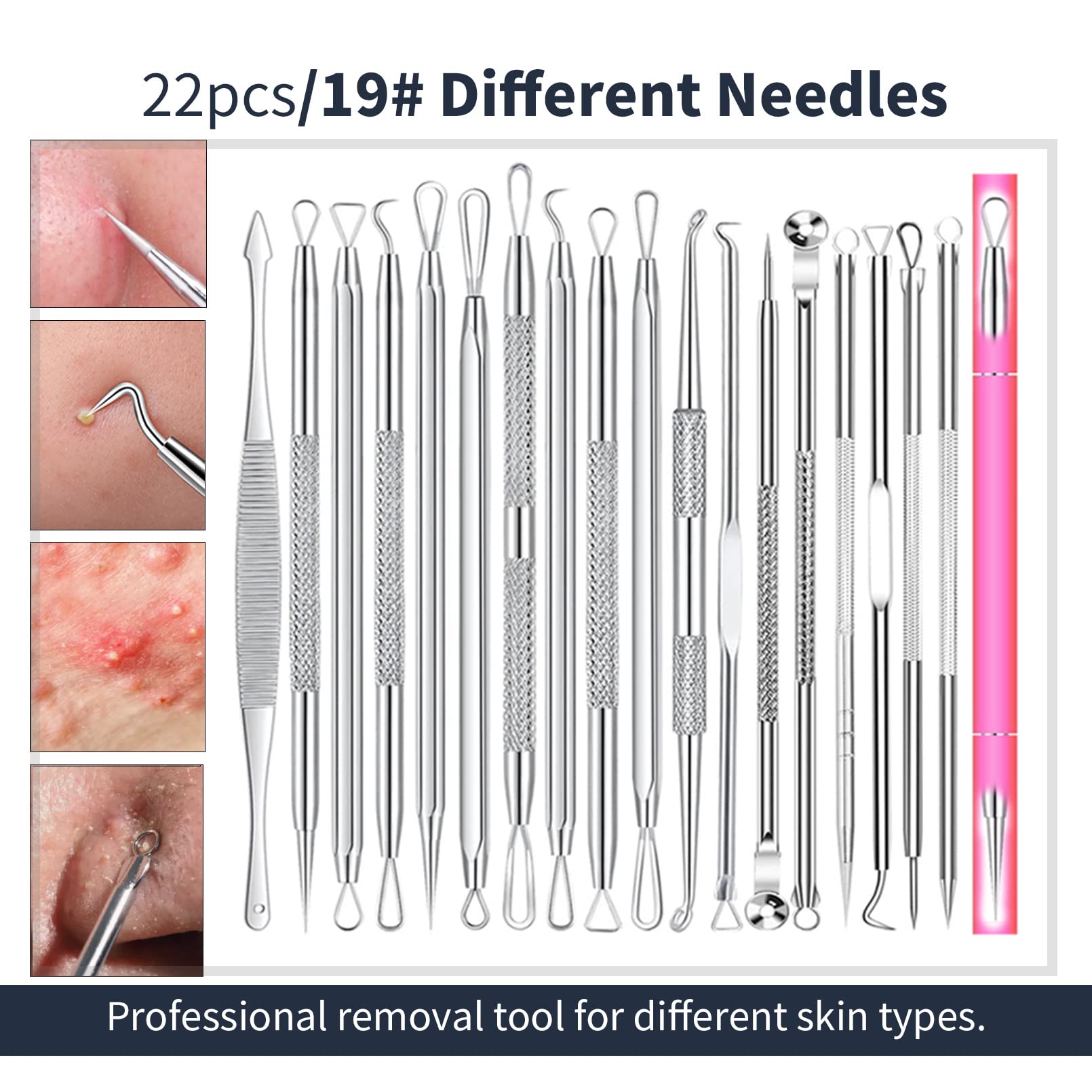 2023 Professional Pimple Popper Tool Kit - 22 Pcs Blackhead Remover Tools For Acne And Zit Popping Comedone Extractor