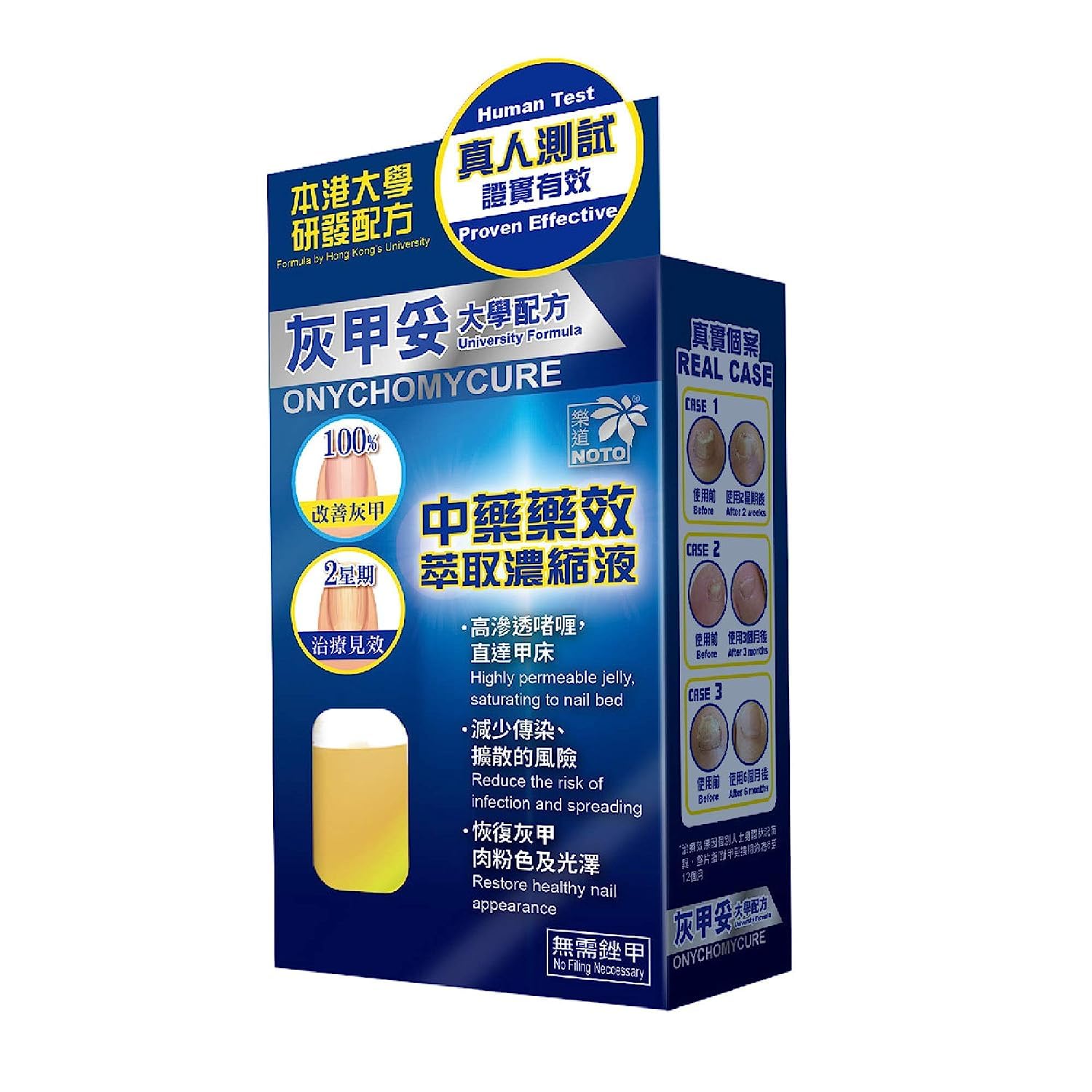 NOTO Onychomycure Strength Toenail Nail Good - Repair Healthy Nail/foot, Foot Care, Appearance Renewal Nail Repair Solution, Fix
