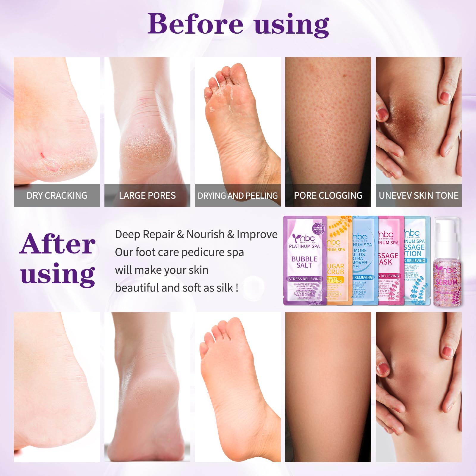 Nbc Beautilab Pedicure Foot Soak Set - Upgraded 6 In 1 Foot Spa, Foot Bath Spa, Pedicure Kit For Tired & Dry Cracked Feet, Athle