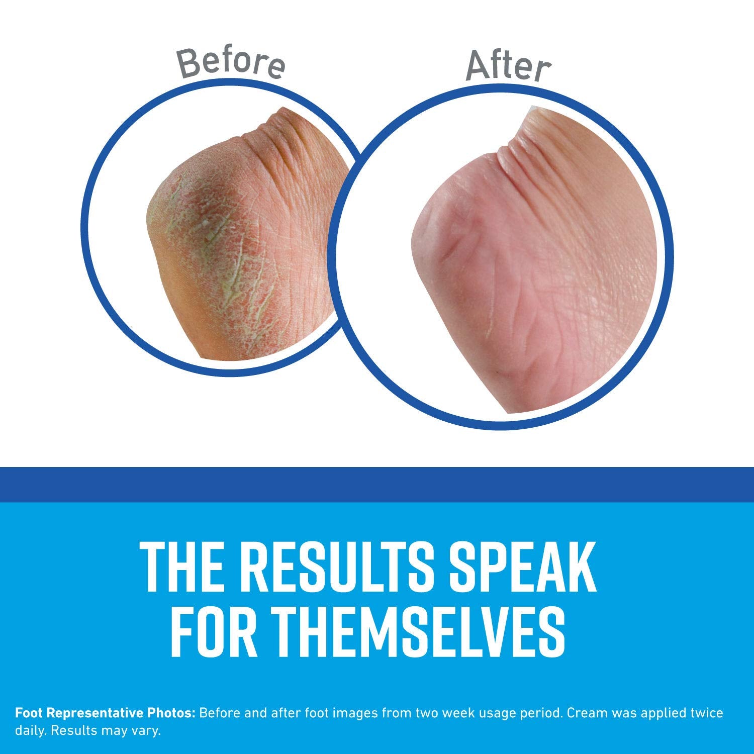O'Keeffe'S For Healthy Feet Foot Cream, Guaranteed Relief For Extremely Dry, Cracked Feet, Clinically Proven To Instantly Boost