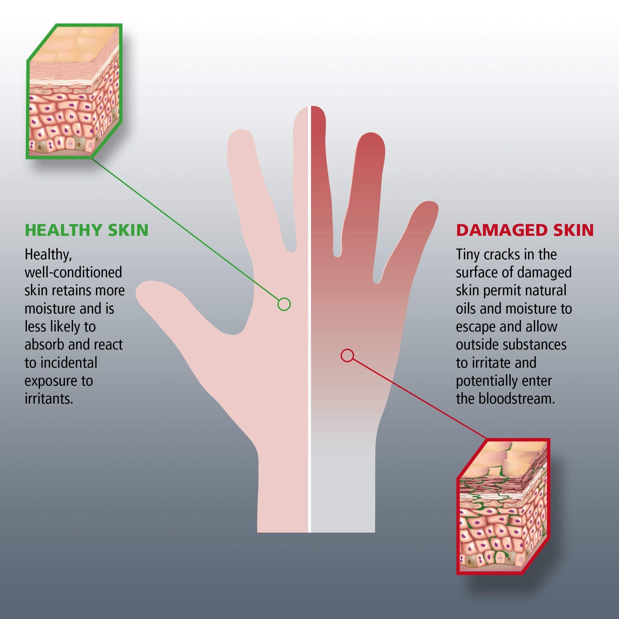 Gojo Hand Medic Professional Skin Conditioner, Fragrance Free, 5 Fl Oz Portable Squeeze Tube (Pack Of 12) - 8150-12