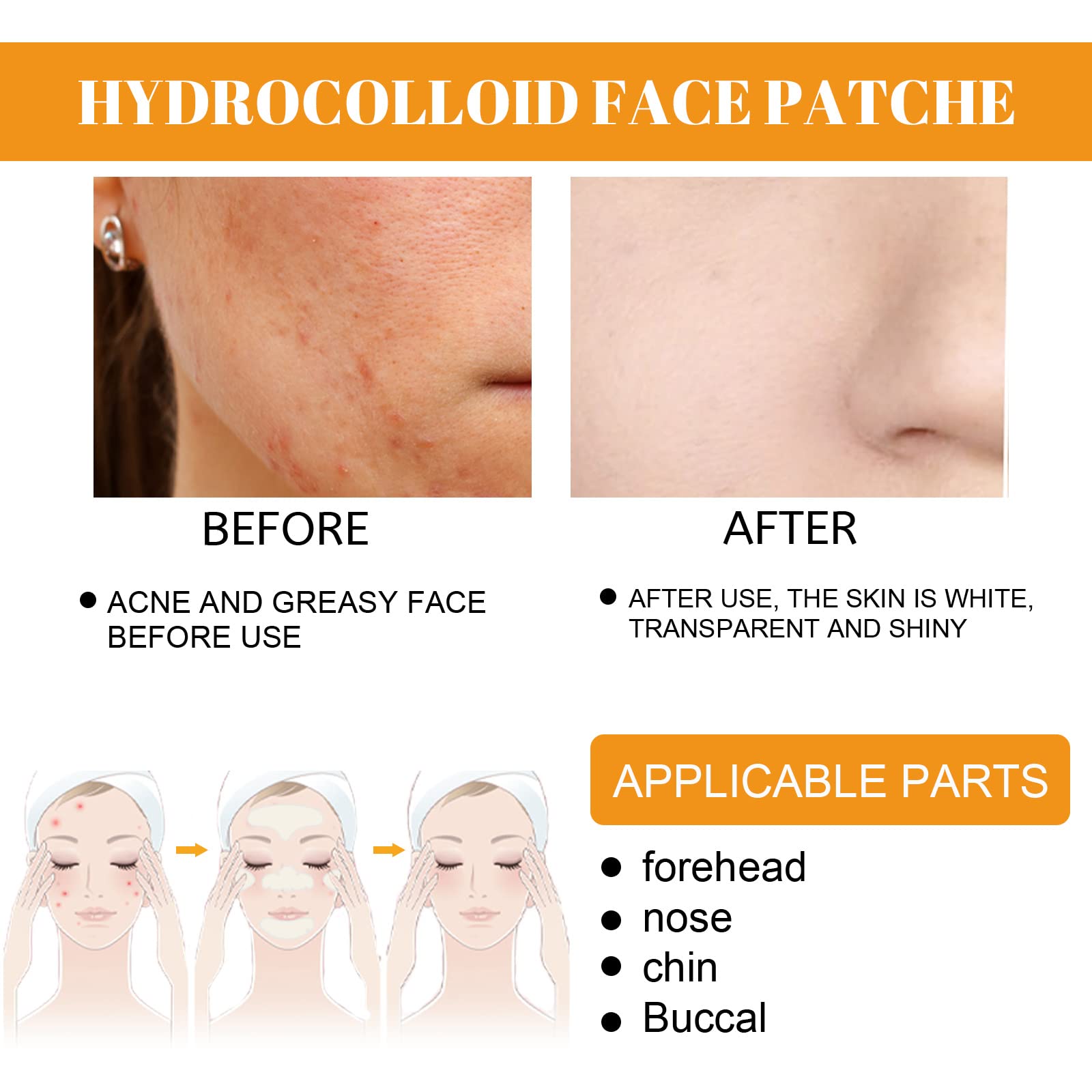 20PCS Hydrocolloid Acne Clearing Patches for Full-Face Spot Coverage - Absorbing Clearing Skin Care for Pimples and Blemishes