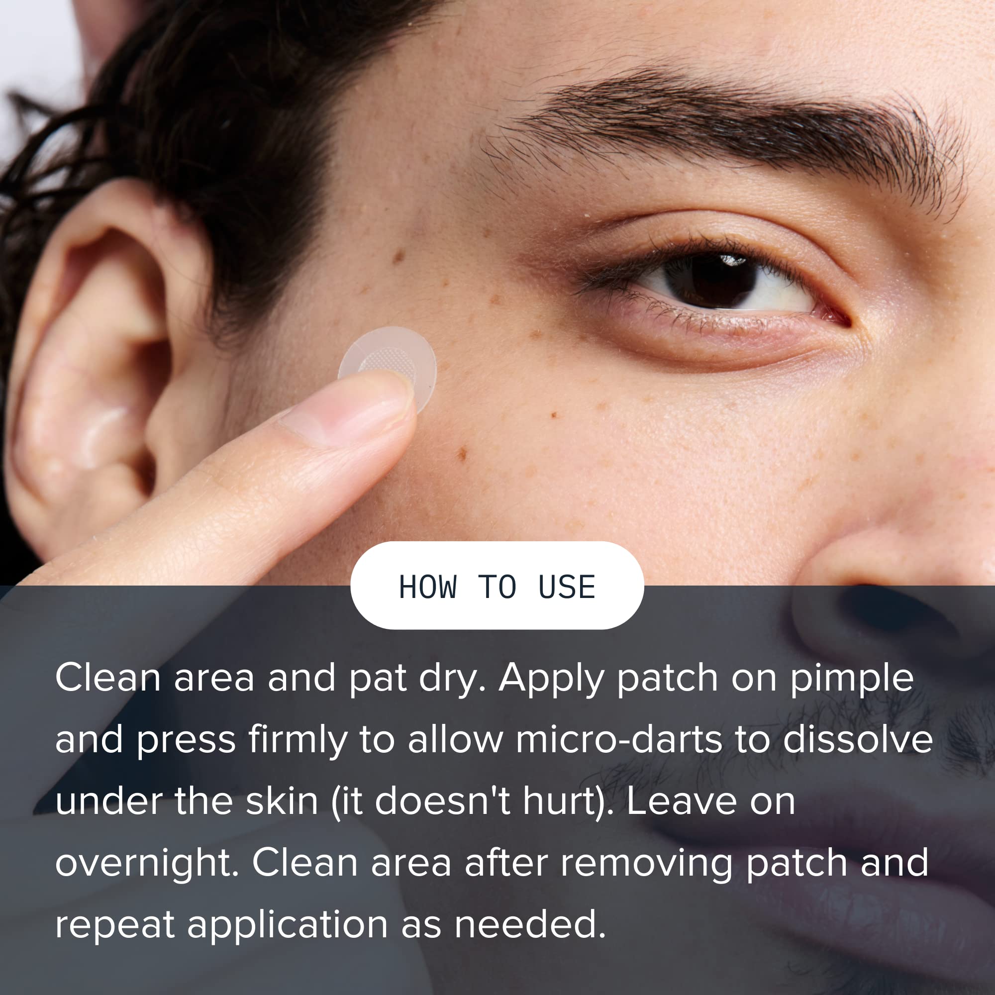 Cardon Prickly Pimple Patches, Spot Acne Treatment For Pimples, Blackheads, Zit Clearing Acne Patches, Salicylic Acid, 1-Step Fa