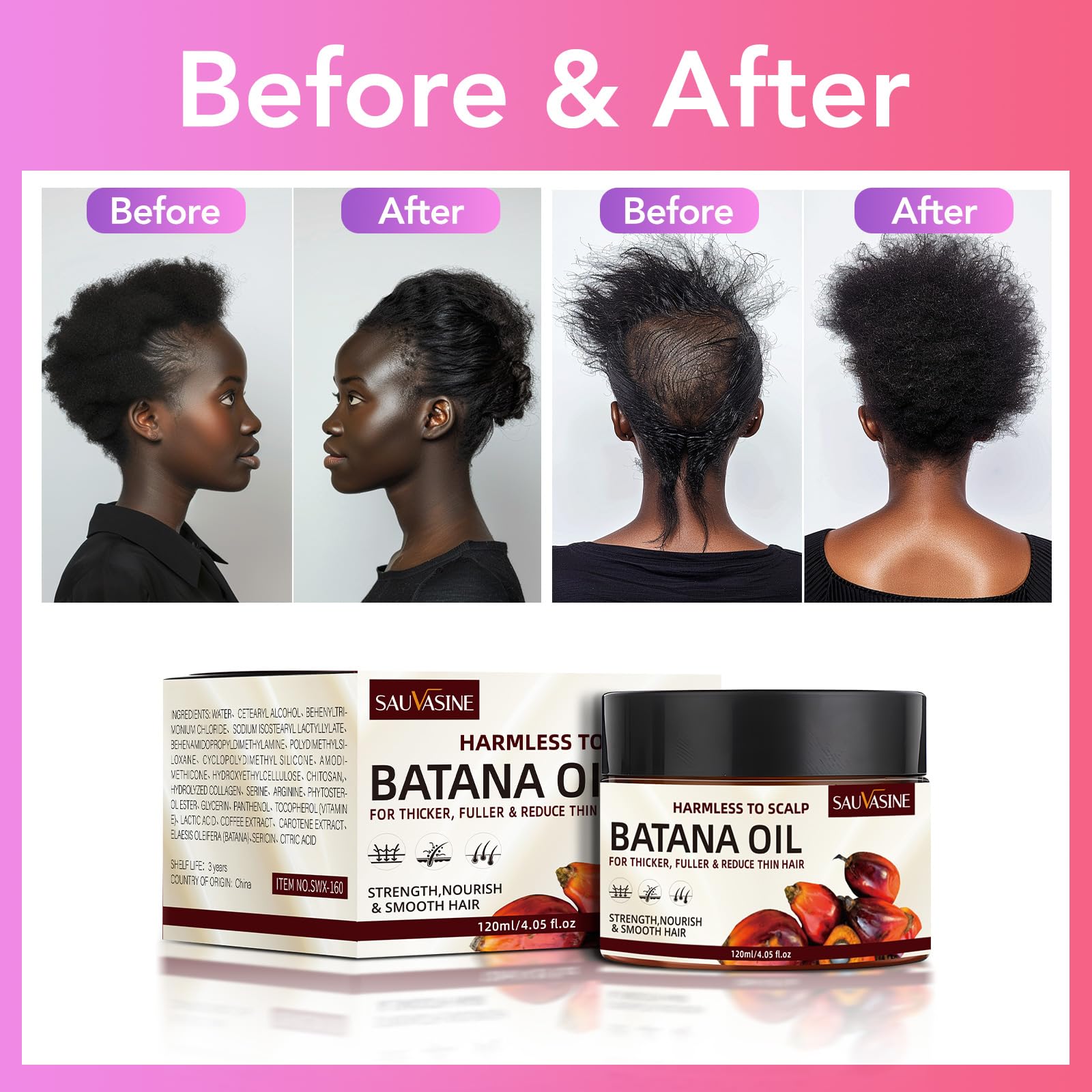 Lanthome Batana Oil For Hair Growth, Natural Dr. Sebi Hair Oil - Prevents Hair Loss, Eliminates Split Ends, Repairs Damaged Hair