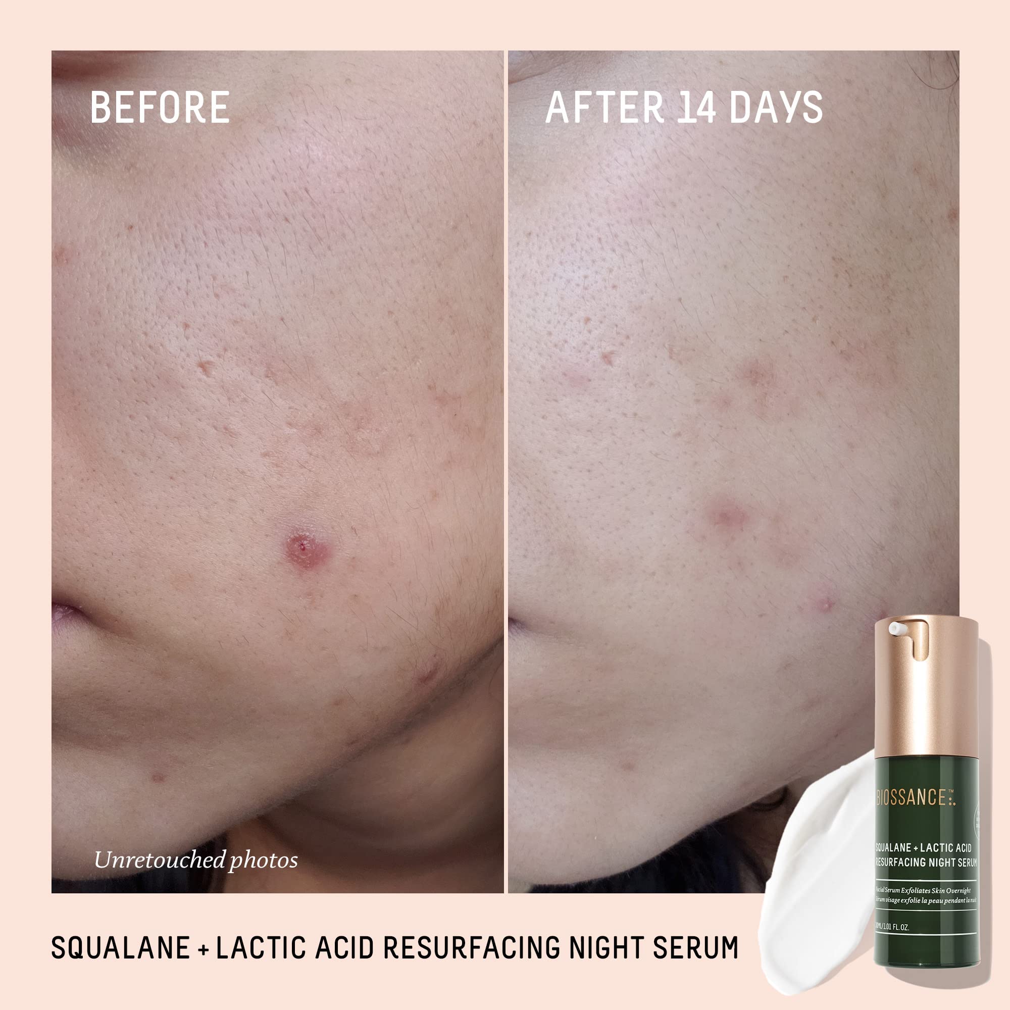 Biossance Rapid Radiance Set