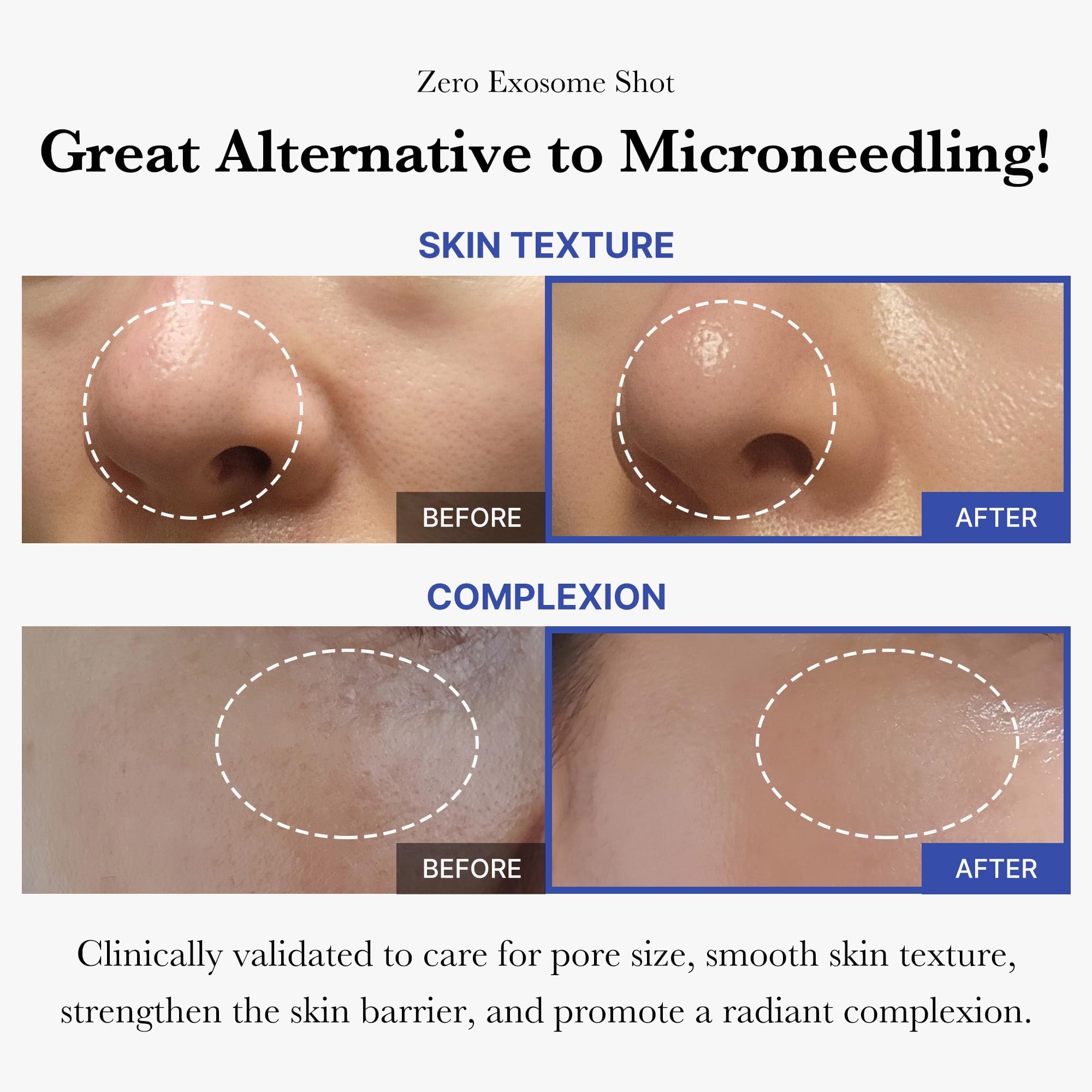 medicube Zero Exosome Shot Facial Serum 1.01 fl. oz | Exosome, AHA+BHA+PHA | Pore Care & Skin Texture Enhancer