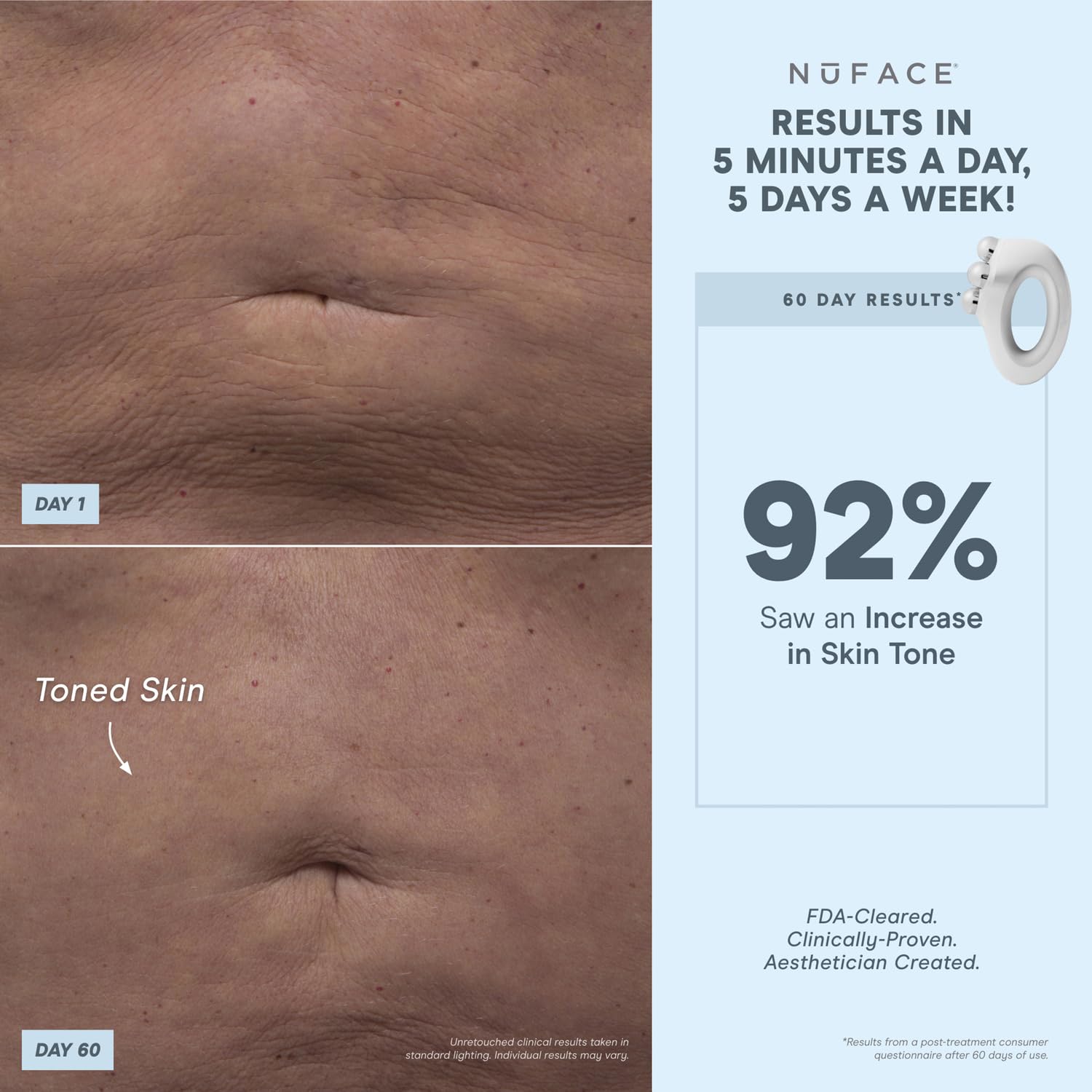 Nuface Nubody Toning Device - Fda Cleared Microcurrent Device For All-Over Contouring, Firming & Skin Tightening