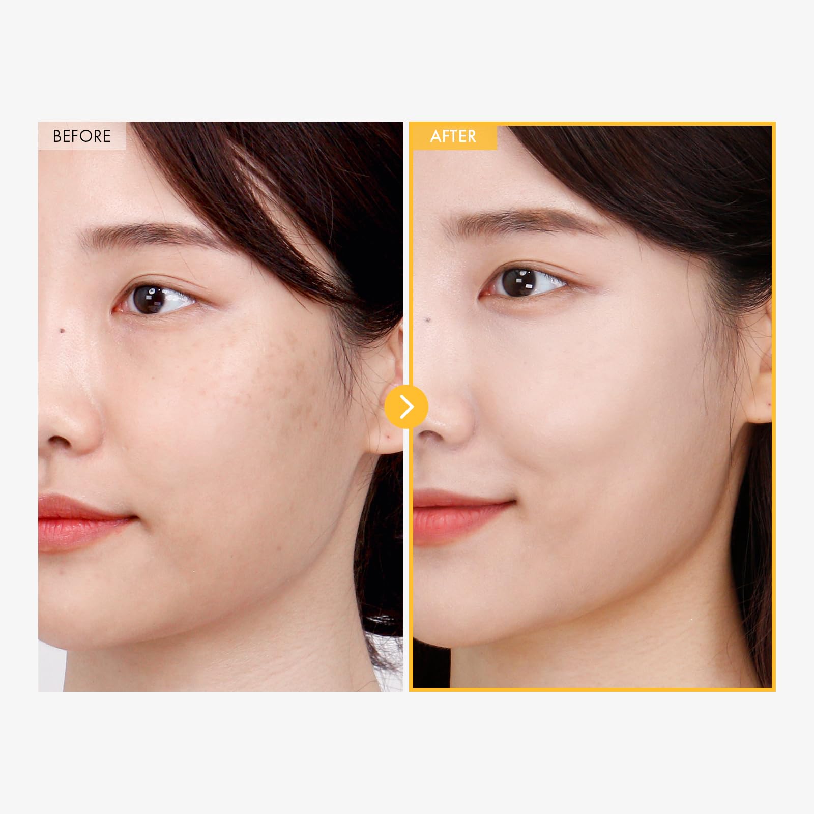 TOSOWOONG 8 Days Spot Cream, Dark Spot Remover for Face, Age Spot, Sun Spot, Freckles, Melasma, Brown Spot Serum, Advanced Formu