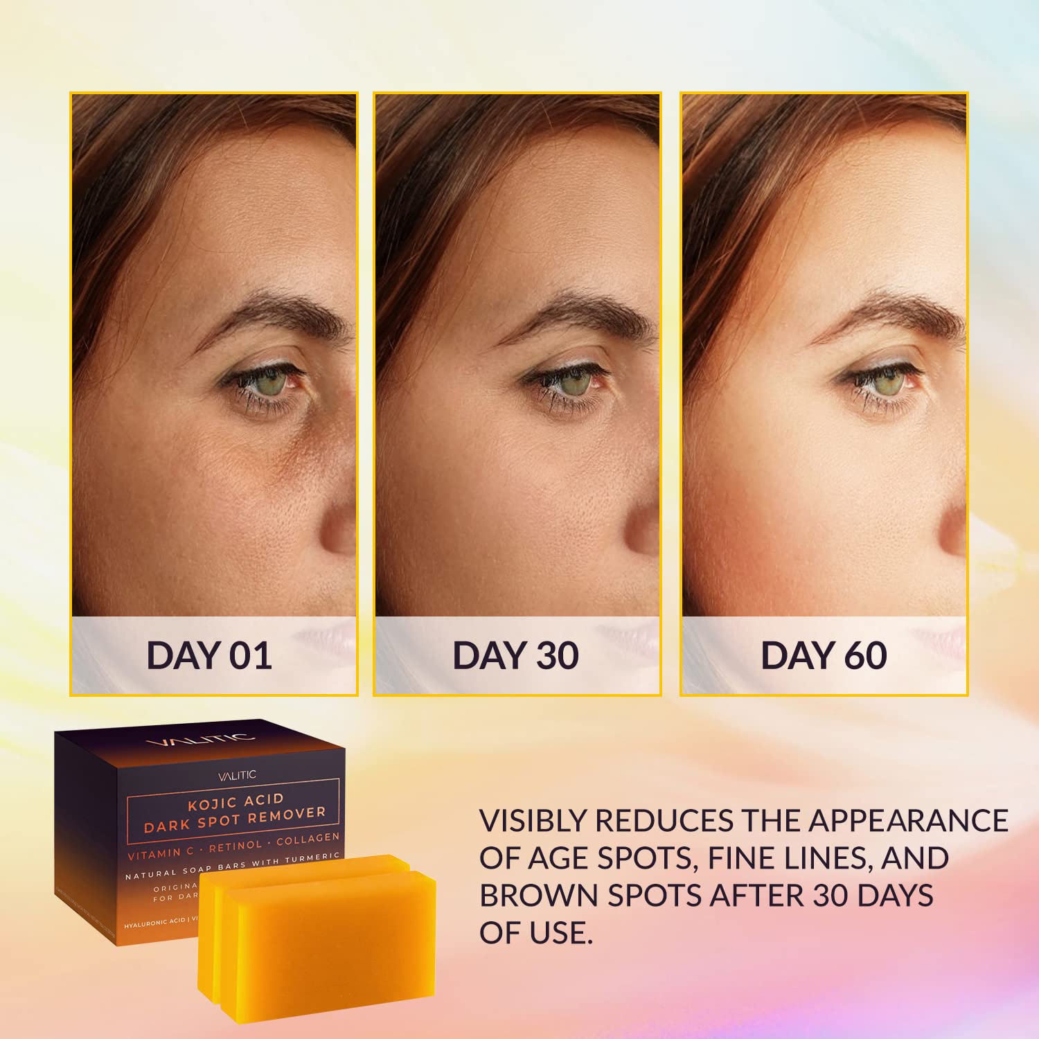 Valitic Kojic Acid Dark Spot Remover Soap Bars With Vitamin C, Retinol, Collagen, Turmeric - Original Japanese Complex Infused W