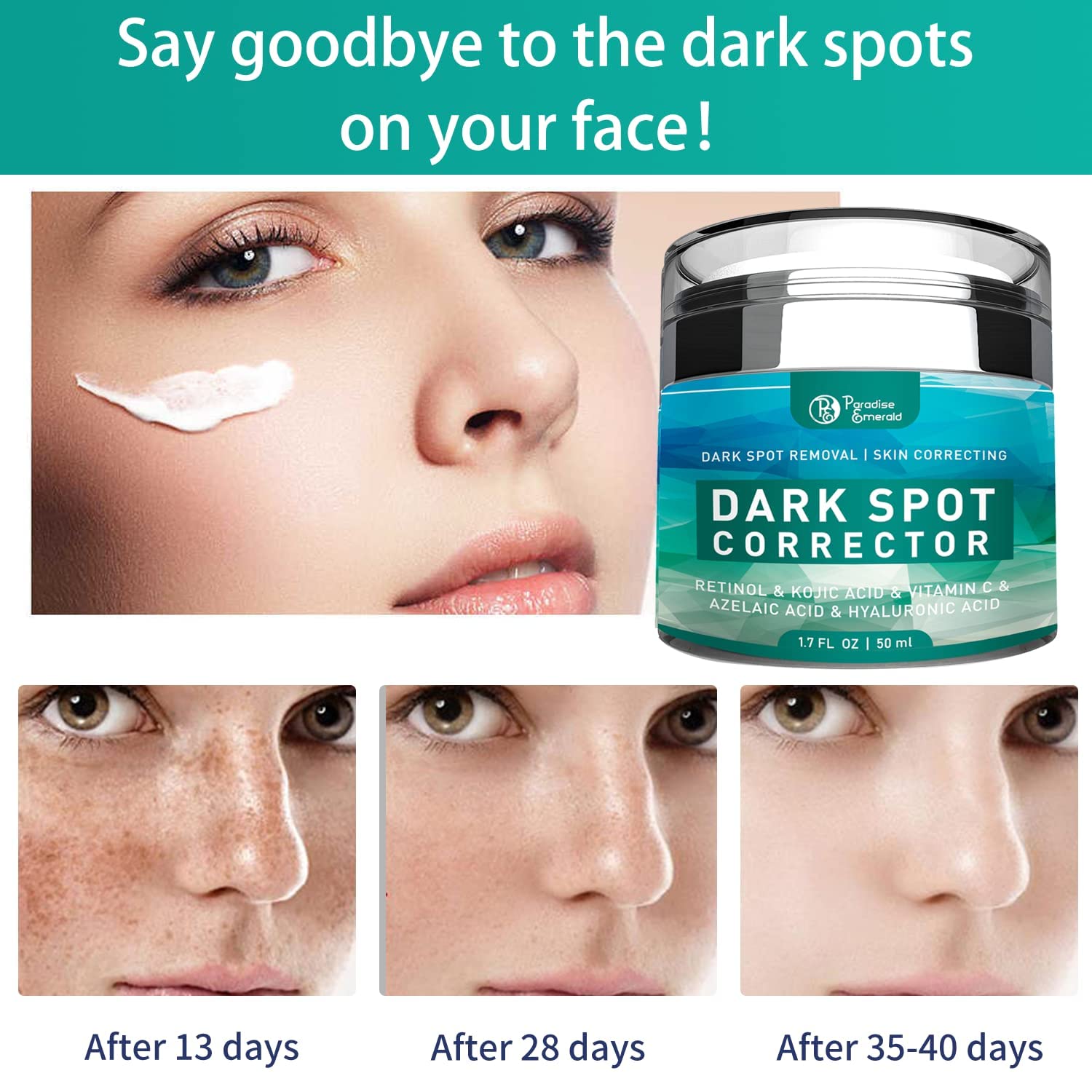 Paradise Emerald Dark Spot Remover For Face, Hyperpigmentation Treatment, Melasma, Freckle, Sun Spots Removal For All Skin Types