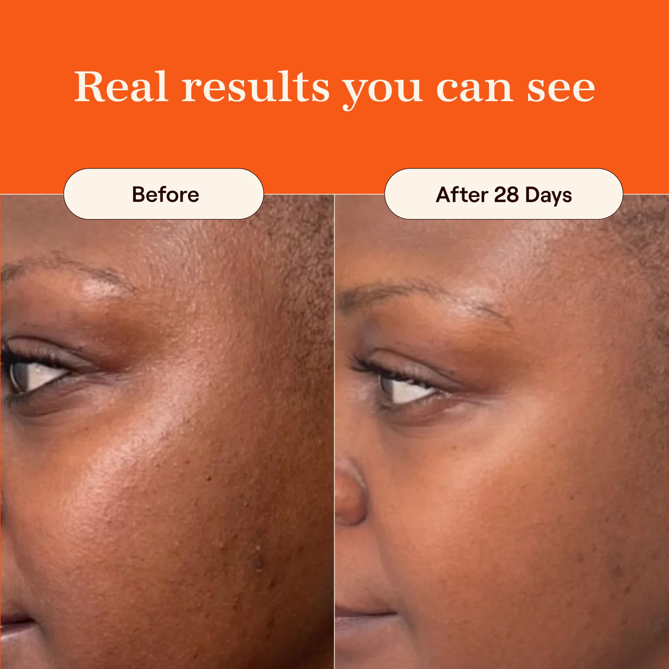 Live Tinted Superhue Travel Size: Hyperpigmentation Serum, Smooth Fine Lines, Fades Dark Spots, Improves Skin Texture and Tone,