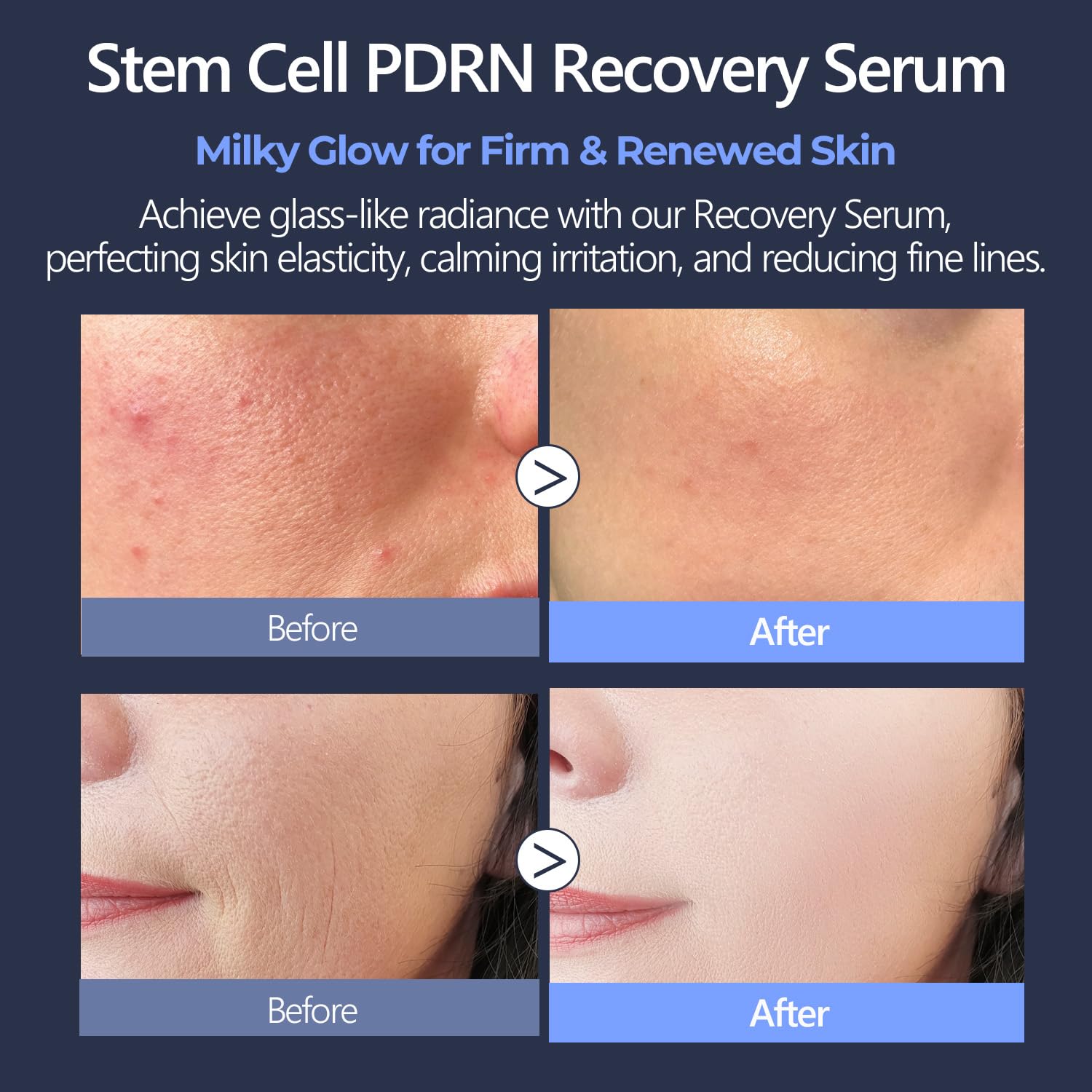 Centella PDRN & CICA Exosome Stem Cell Serum for Face 1.01 fl oz - Anti-Aging, Firming & Rejuvenating Facial Serum with Bakuchio