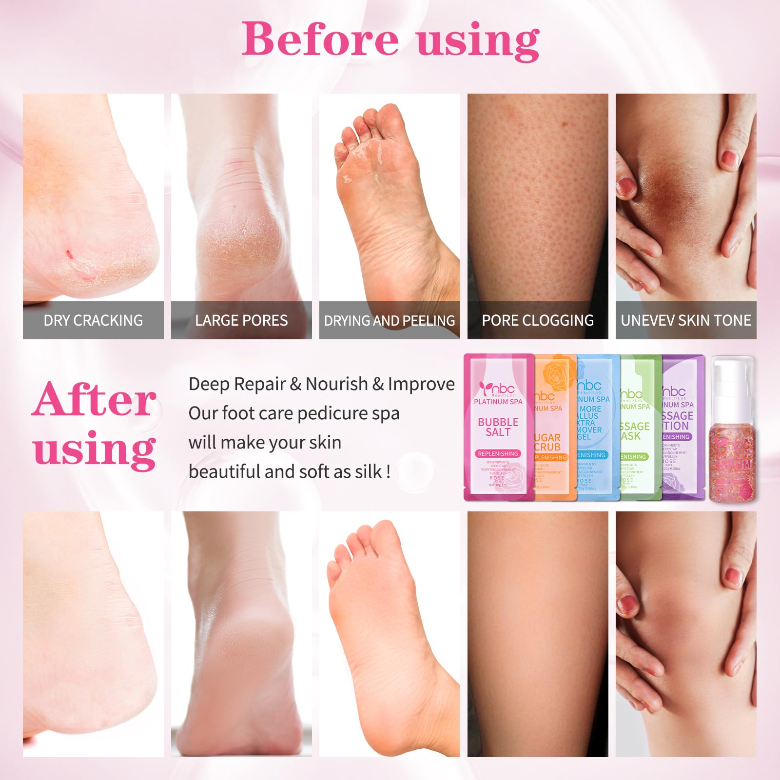 Nbc Beautilab Pedicure Foot Soak Set - Upgraded 6 In 1 Foot Spa, Foot Bath Spa, Pedicure Kit, Foot Soak For Tired & Dry Cracked