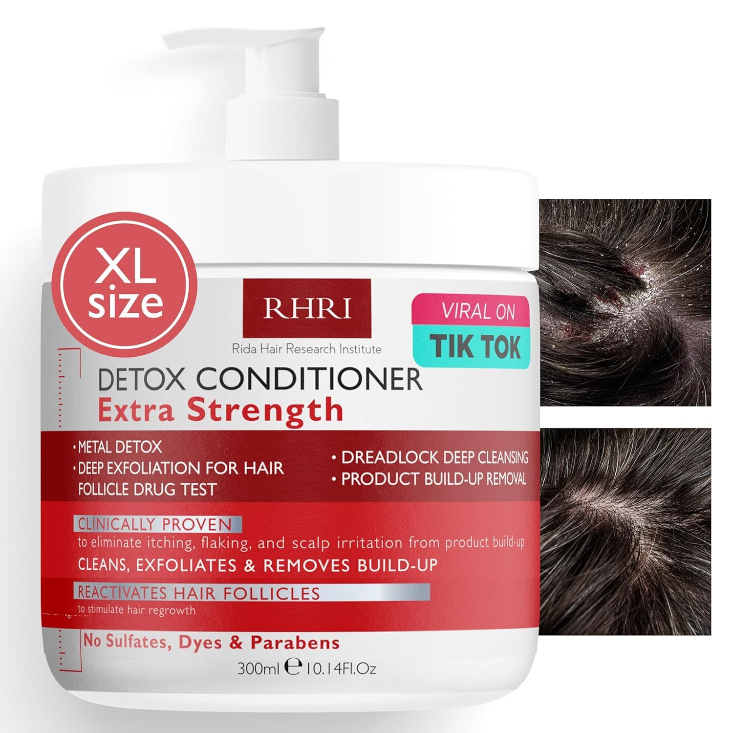 Detox Conditioner for Men and Women | Extra Strength and Deep Cleansing for Scalp & Hair | Metal Detox, Build-Up Removal & Hair 