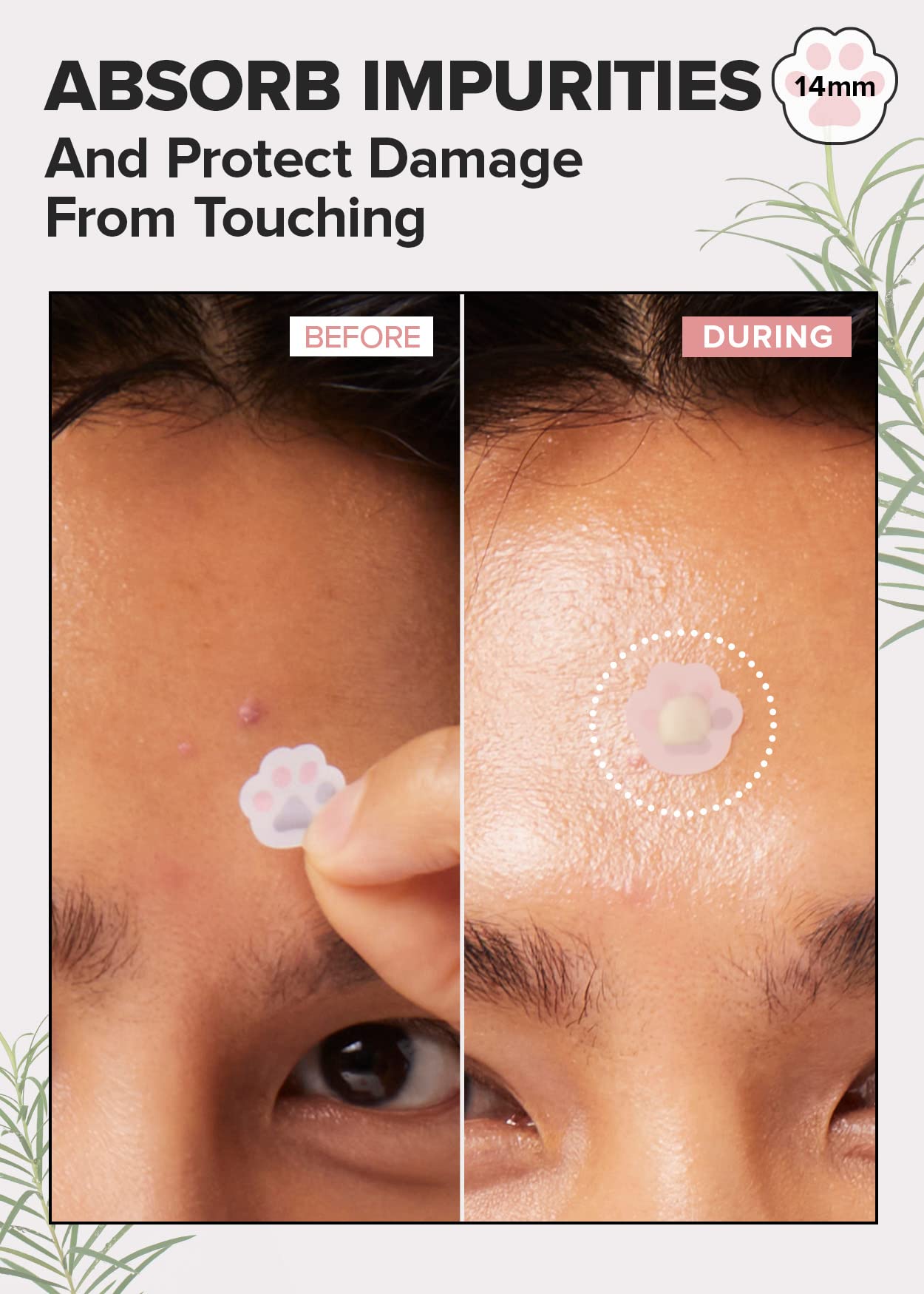 I Dew Care Hydrocolloid Acne Pimple Patch - Timeout Blemish Happy Paws | Korean Cute Acne Patches | Zit Patches For Face And Ski