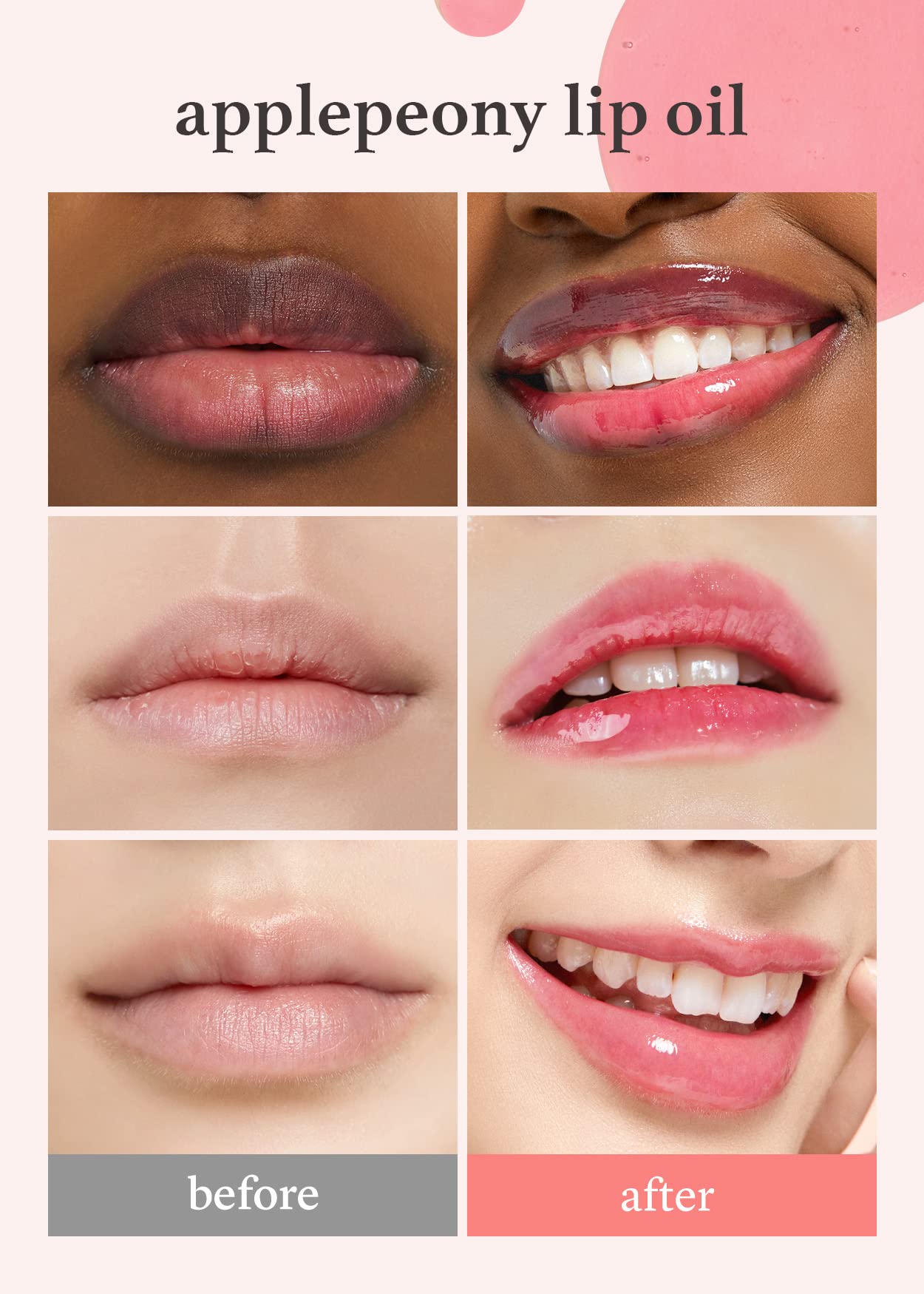 Nooni Korean Lip Oil - Applepeony | Lip Stain, Gift, Long-Lasting, Moisturizing, Plumping, Revitalizing For Dry Lips, Waterproof