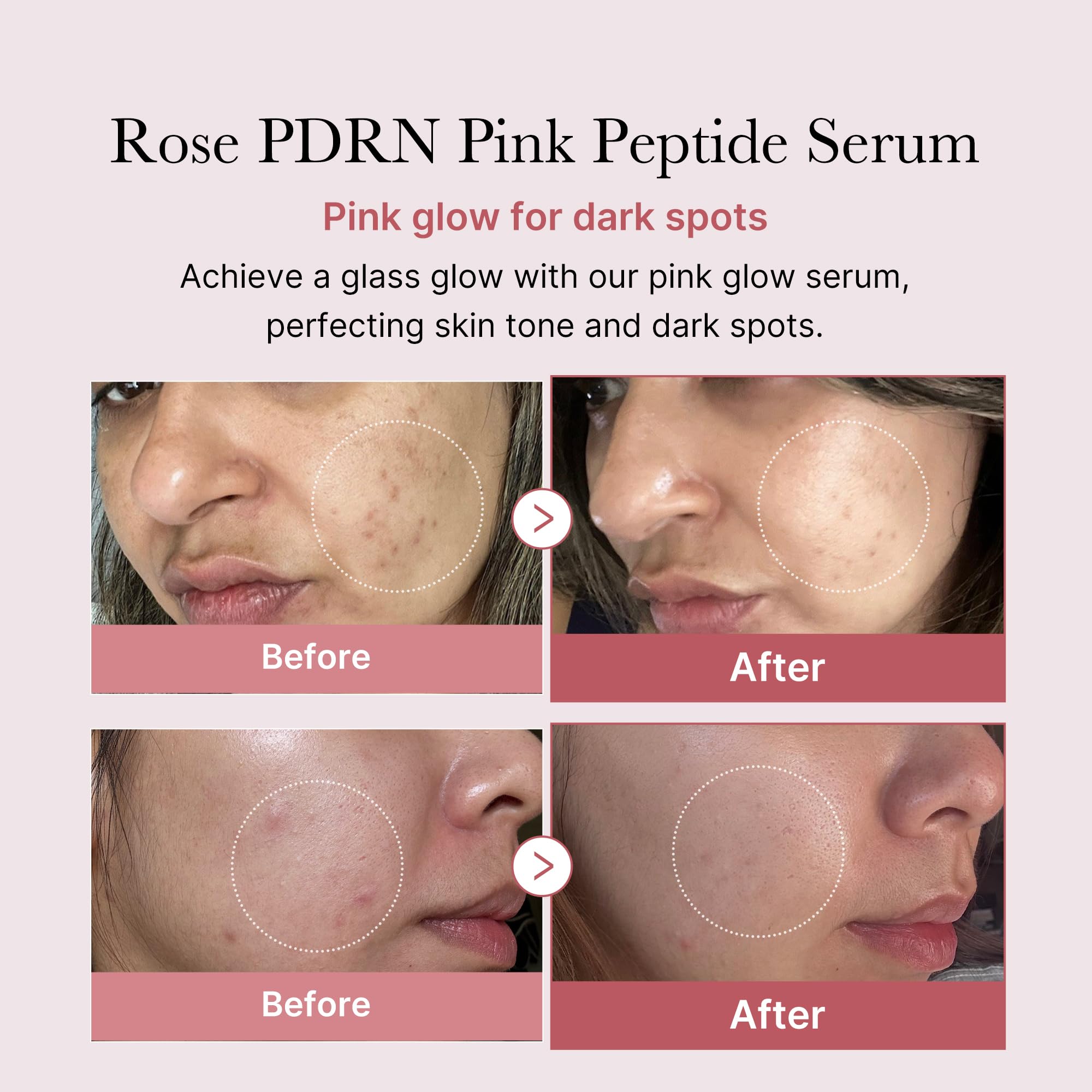 medicube PDRN Pink Peptide Serum - Hydrating, Firming, Niacinamide, 1.01 fl. oz., Vegan Korean Skincare