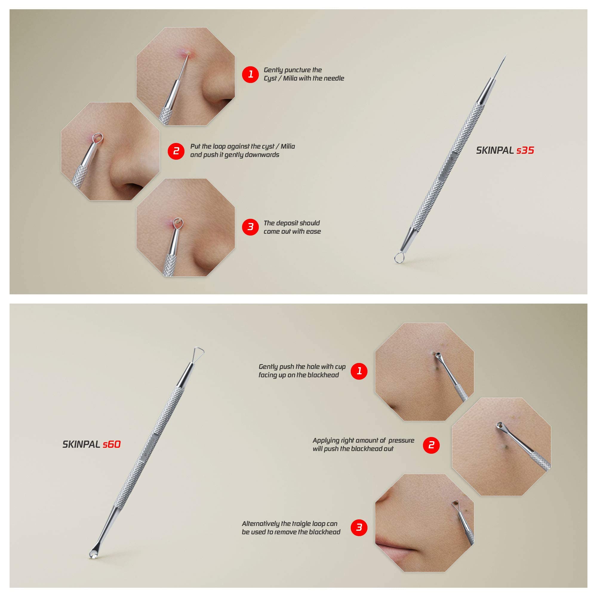 Suvorna Skinpal Pimple Popper Tool Kit  Milia Remover  Lancets For Facial Extraction  Whitehead Extractor Tool  Comedone Extract