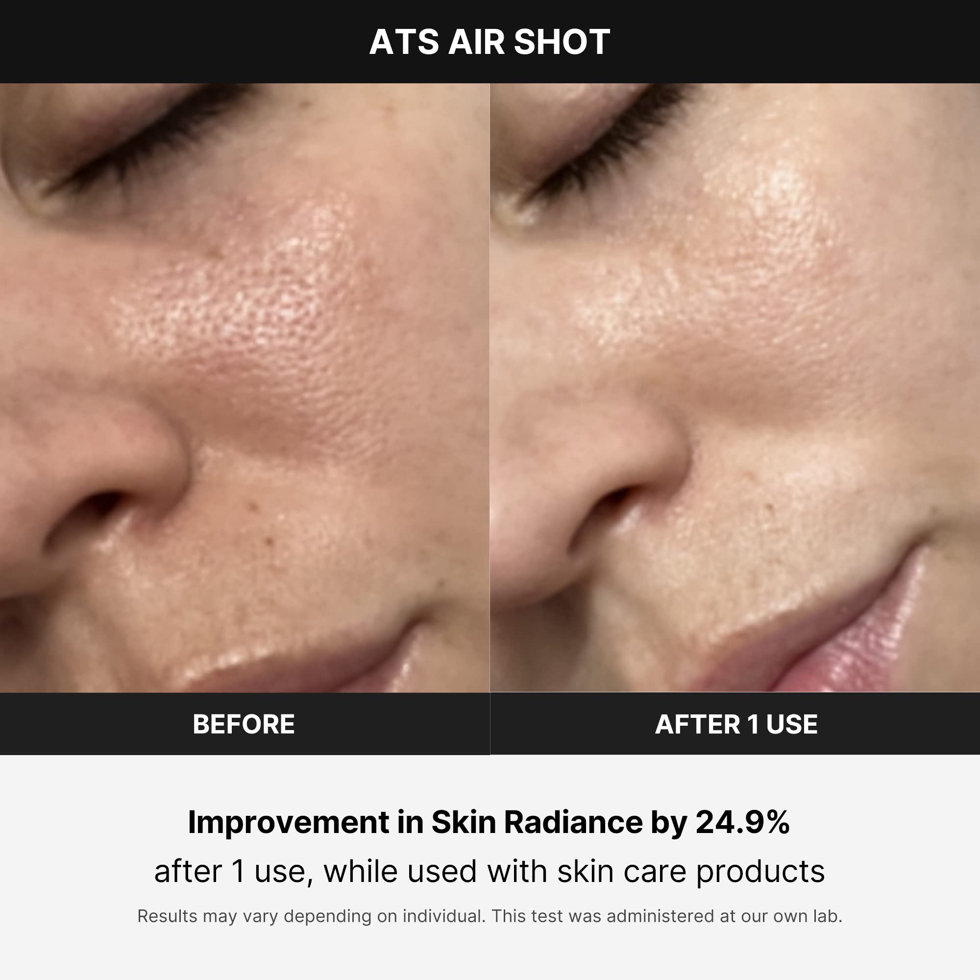 Medicube Age-R Ats Air Shot - Microneedling Skin Care Device For Pore Tightening, Enhanced Absorption, And Smoother Skin Texture