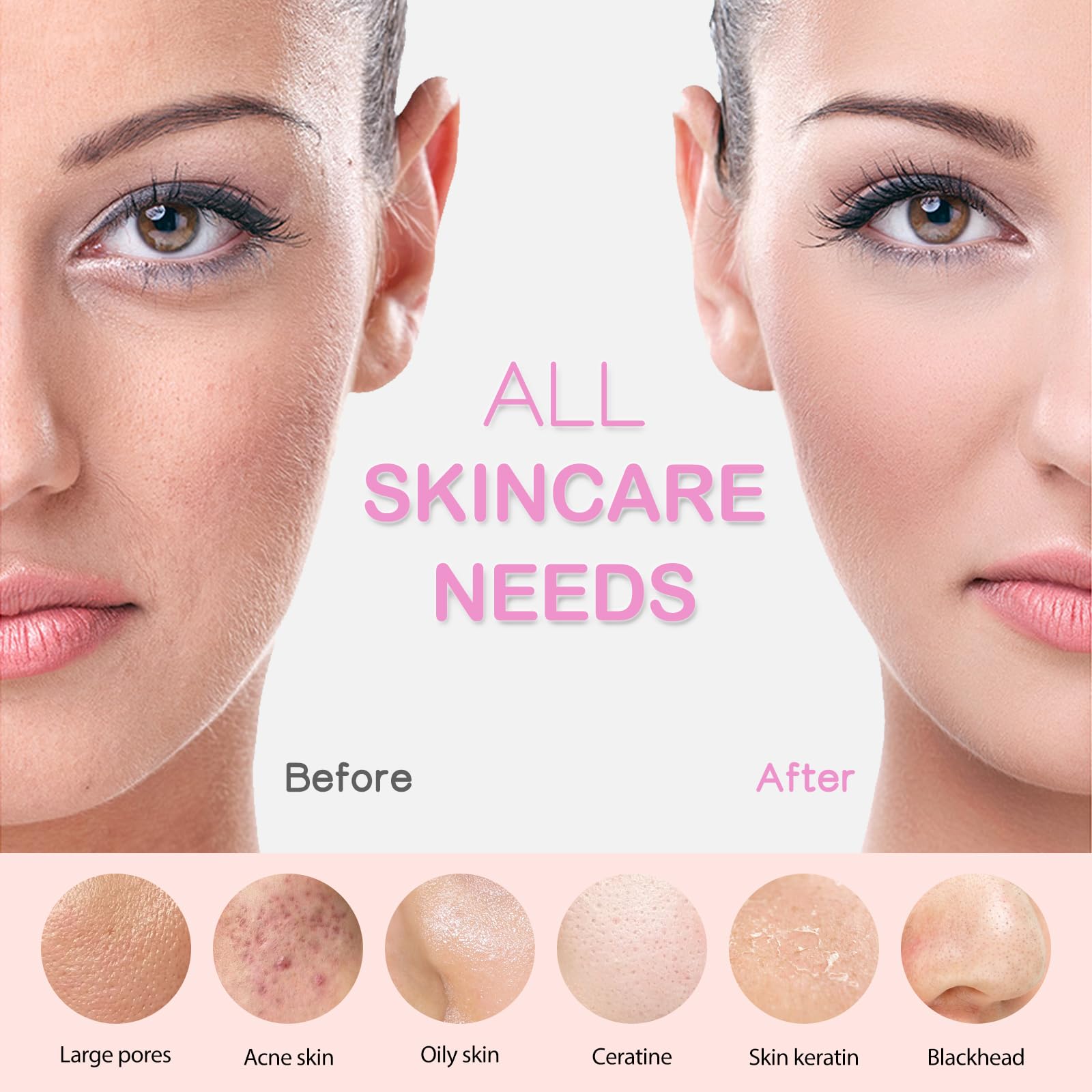 Pritech Silicone Face Scrubber, Rechargeable Facial Cleansing Brush With Heat Massage End, Vibrating Exfoliating Face Scrubber F