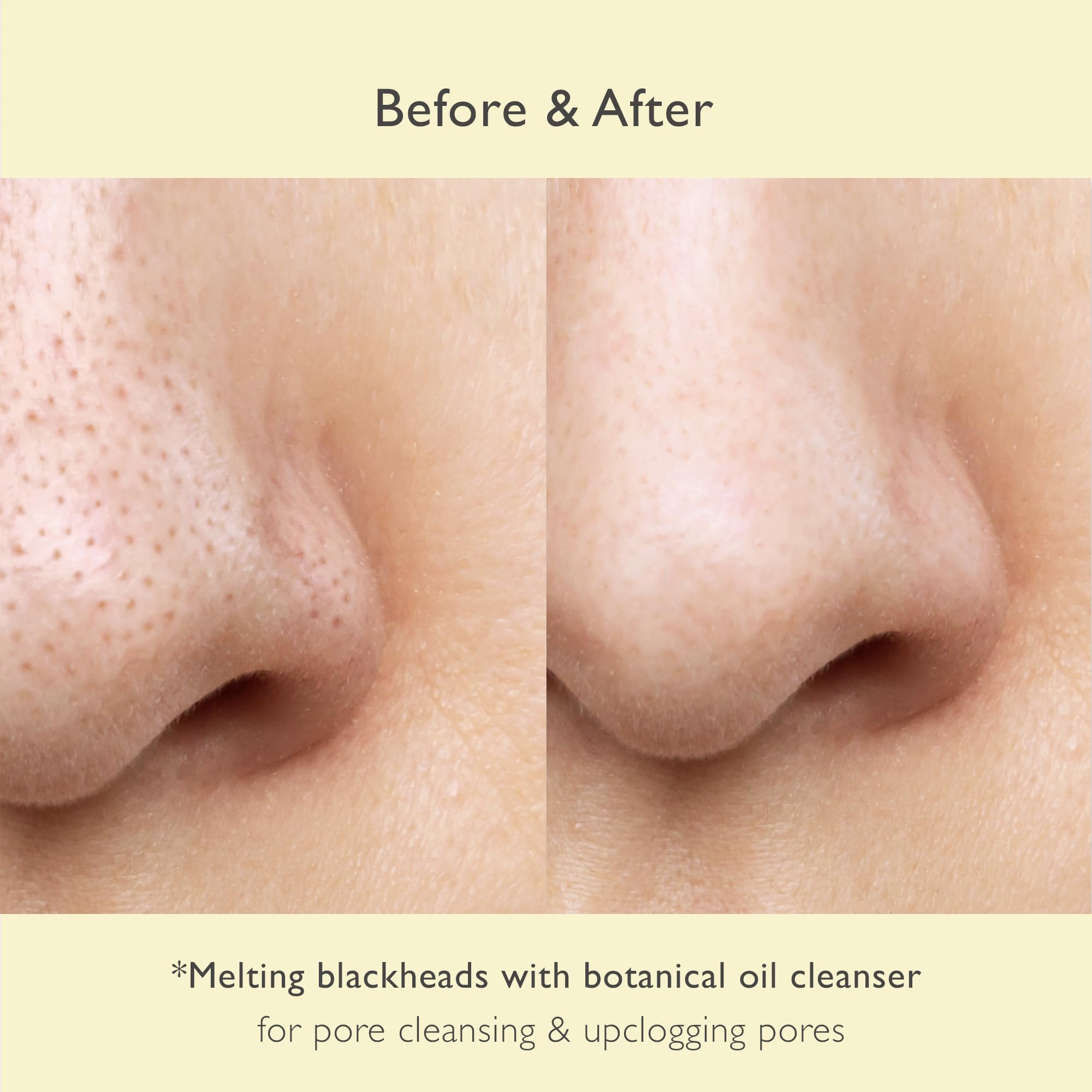 Nowater No Pore Cleansing Oil | Makeup Cleansing Oil | Pore Cleansing, Blackheads Removal | Olive Oil, Tea Tree, Squalane | Kore