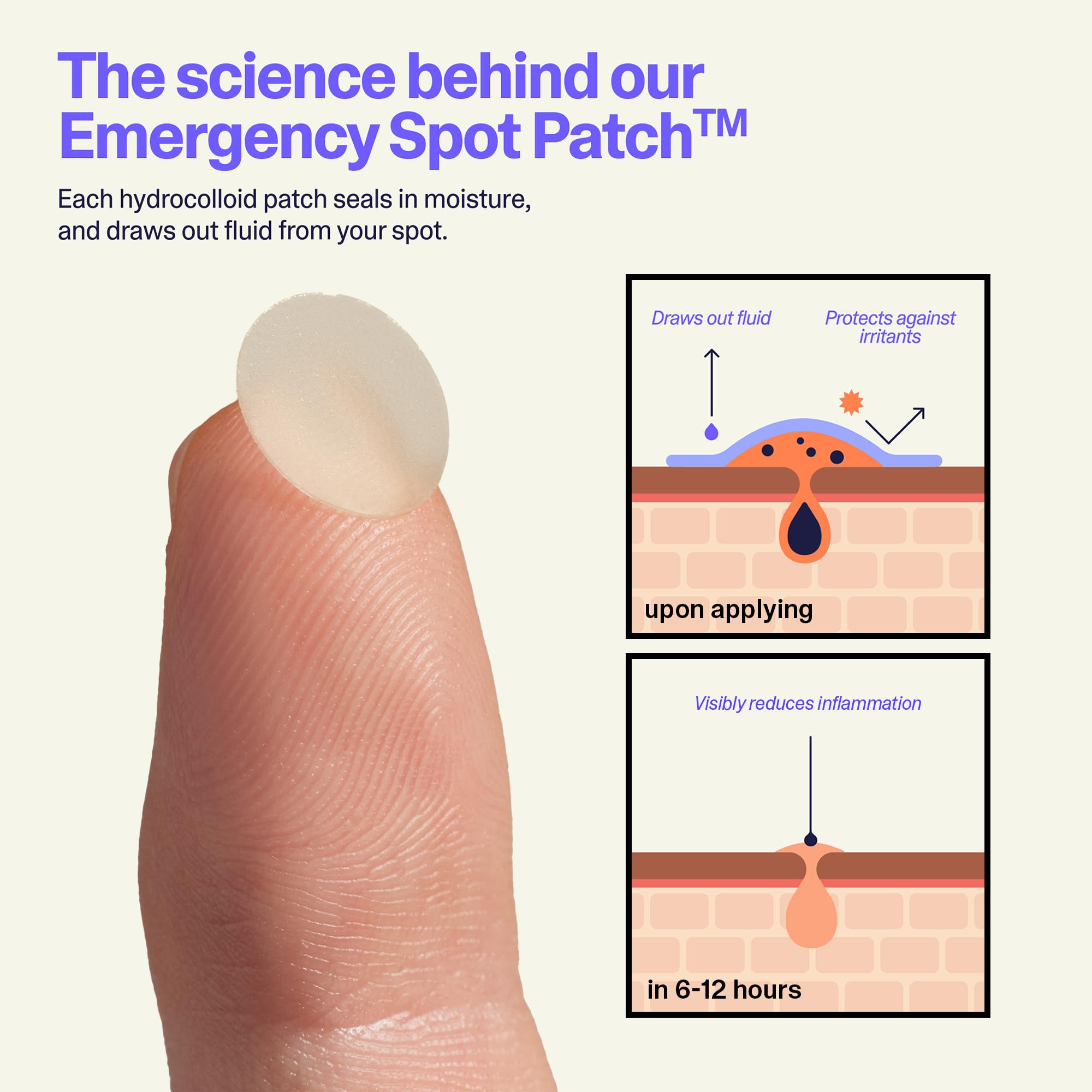 Curology Emergency Spot Pimple Patches For Face, Hydrocolloid Pimple Patches Fast-Acting Support, Spot Concealing And Oil Absorb